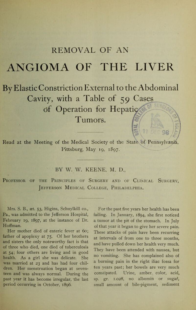 REMOVAL OF AN ANGIOMA OF THE LIVER By Elastic Constriction External to the Abdominal Cavity, with a Table of 59 Cases of Operation for Hepatic Tumors. Read at the Meeting of the Medical Society of the State of Pennsylvar Pittsburg, May 19, 1897. BY W. W. KEENE, M. D., Professor of the Principles of Surgery and of Clinical Surgery, Jefferson Medical College, Philadelphia. Mrs. S. B., set. 53, Higins, Schuylkill co., Pa., was admitted to the Jefferson Hospital, February 19, 1897, at the instance of Dr. Hoffman. Her mother died of enteric fever at 60; father of apoplexy at 75. Of her brothers and sisters the only noteworthy fact is that of three who died, one died of tuberculosis at 54; four others are living and in good health. As a girl she was delicate. She wras married at 23 and has had four chil- dren. Her menstruation began at seven- teen and was always normal. During the past year it has become irregular, the last period occurring in October, 1896. For the past five years her health has been failing. In January, 1894, she first noticed a tumor at the pit of the stomach. In July of that year it began to give her severe pain. These attacks of pain have been recurring at intervals of from one to three months, and have pulled down her health very much. They have been attended with nausea, but no vomiting. She has complained also of a burning pain in the right iliac fossa for ten years past; her bowels are very much constipated. Urine, amber color, acid, sp. gr. 1.028, no albumin or sugaf, small amount of bile-pigment, sediment