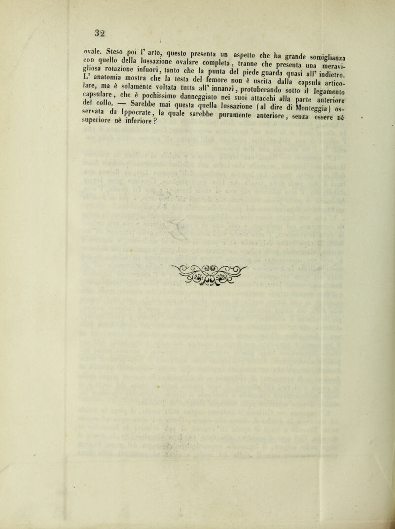 ovale. Steso poi ]’ arto, questo presenta un aspetto che ha grande somiglianza con quello della lussatone «vaiare completa, tranne che presenta unTmeravi- I ’ ZI°ne ,nf0”’t.aDt0 che ,a Pllnta del piede guarda quasi all’indietro anatomia mostra che la lesta del femore non è uscita dalla capsula artico- aie, ma è solamente voltata tutta all’ innanzi, proliferando sotto il legamento capsulare, che è pochissimo danneggiato nei suoi attacchi alla parte anteriore e C° °à T Sarebbe mai (Iuesta <ìuella lussazione (al dire di Monteg*ia) os * qua,e sarebi>e prarae,e à