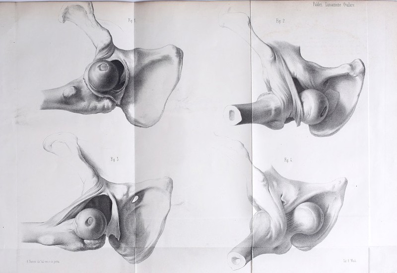 O.Haimini àis'dalvsro sin pietra..