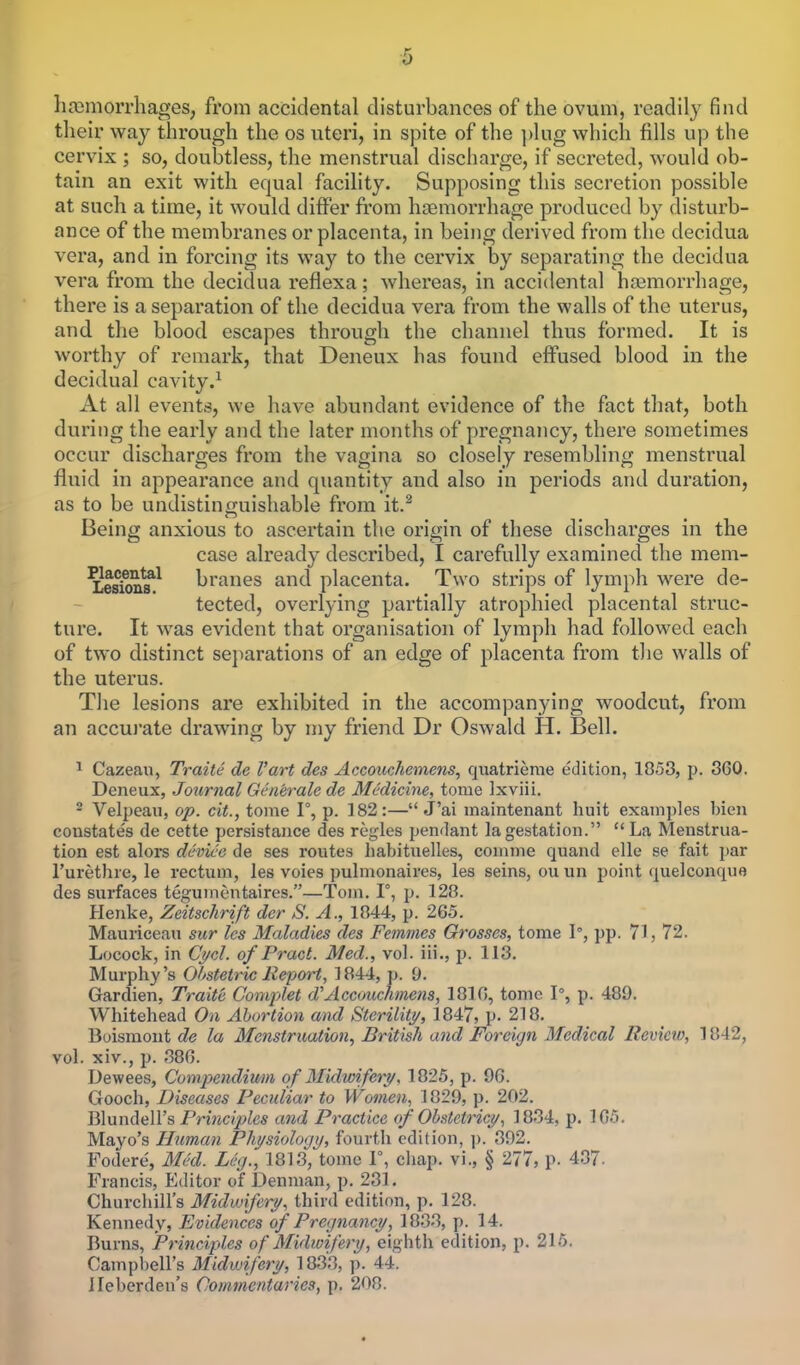 haemorrhages, from accidental disturbances of the ovum, readily find their way through the os uteri, in spite of the plug which fills up the cervix ; so, doubtless, the menstrual discharge, if secreted, would ob- tain an exit with equal facility. Supposing this secretion possible at such a time, it would differ from haemorrhage produced by disturb- ance of the membranes or placenta, in being derived from the decidua vera, and in forcing its way to the cervix by separating the decidua vera from the decidua reflexa; whereas, in accidental hemorrhage, there is a separation of the decidua vera from the walls of the uterus, and the blood escapes through the channel thus formed. It is worthy of remark, that Deneux has found effused blood in the decidual cavity.1 At all events, we have abundant evidence of the fact that, both during the early and the later months of pregnancy, there sometimes occur discharges from the vagina so closely resembling menstrual fluid in appearance and quantity and also in periods and duration, as to be undistinguishable from it.2 Being anxious to ascertain the origin of these discharges in the case already described, I carefully examined the mem- Lesiozuf1 branes and placenta. Two strips of lymph were de- tected, overlying partially atrophied placental struc- ture. It was evident that organisation of lymph had followed each of two distinct separations of an edge of placenta from the walls of the uterus. The lesions are exhibited in the accompanying woodcut, from an accurate drawing by my friend Dr Oswald H. Bell. 1 Cazeau, Traite de Vart des Accouchemens, quatrieme edition, 1853, p. 360. Deneux, Journal Generate de Medicine, tome Ixviii. 2 Velpeau, op. cit., tome 1°, p. 182:— J'ai maintenant huit examples bien constates de cette persistance des regies pendant la gestation.  La Menstrua- tion est alors device de ses routes habituelles, conime quand elle se fait par l'urethre, le rectum, les voies pulmonaires, les seins, ouun point quelconque des surfaces tegumentaires.—Tom. 1°, p. 128. Henke, Zeitschrift der S. A., 1844, p. 265. Mauriceau sur les Maladies des Femmes Grosses, tome I, pp. 71, 72. Locock, in Cycl. of Pract. Med., vol. Hi., p. 113. Murphy's Obstetric Report, 1844, p. 9. Gardien, Traite Complet d'Accouchmens, 1816, tome 1°, p. 489. Whitehead On Abortion and Sterility, 1847, p. 218. Boismont de la Menstruation, British and Foreign Medical Review, 1842, vol. xiv., p. 386. Dewees, Compendium of Midwifery, 1825, p. 96. Gooch, Diseases Peculiar to Women, 1829, p. 202. Blundell's Principles and Practice of Obstelricy, 1834, p. 165. Mayo's Human Physiology, fourth edition, p. 392. Fodere, Med. Leg., 1813, tome 1°, chap, vi., § 277, p. 437. Francis, Editor of Denman, p. 231. Churchill's Midwifery, third edition, p. 128. Kennedy, Evidences of Pregnancy, 1833, p. 14. Burns, Principles of Midwifery, eighth edition, p. 215. Campbell's Midwifery, 1833, p. 44. lleberden's Commentaries, p. 208.