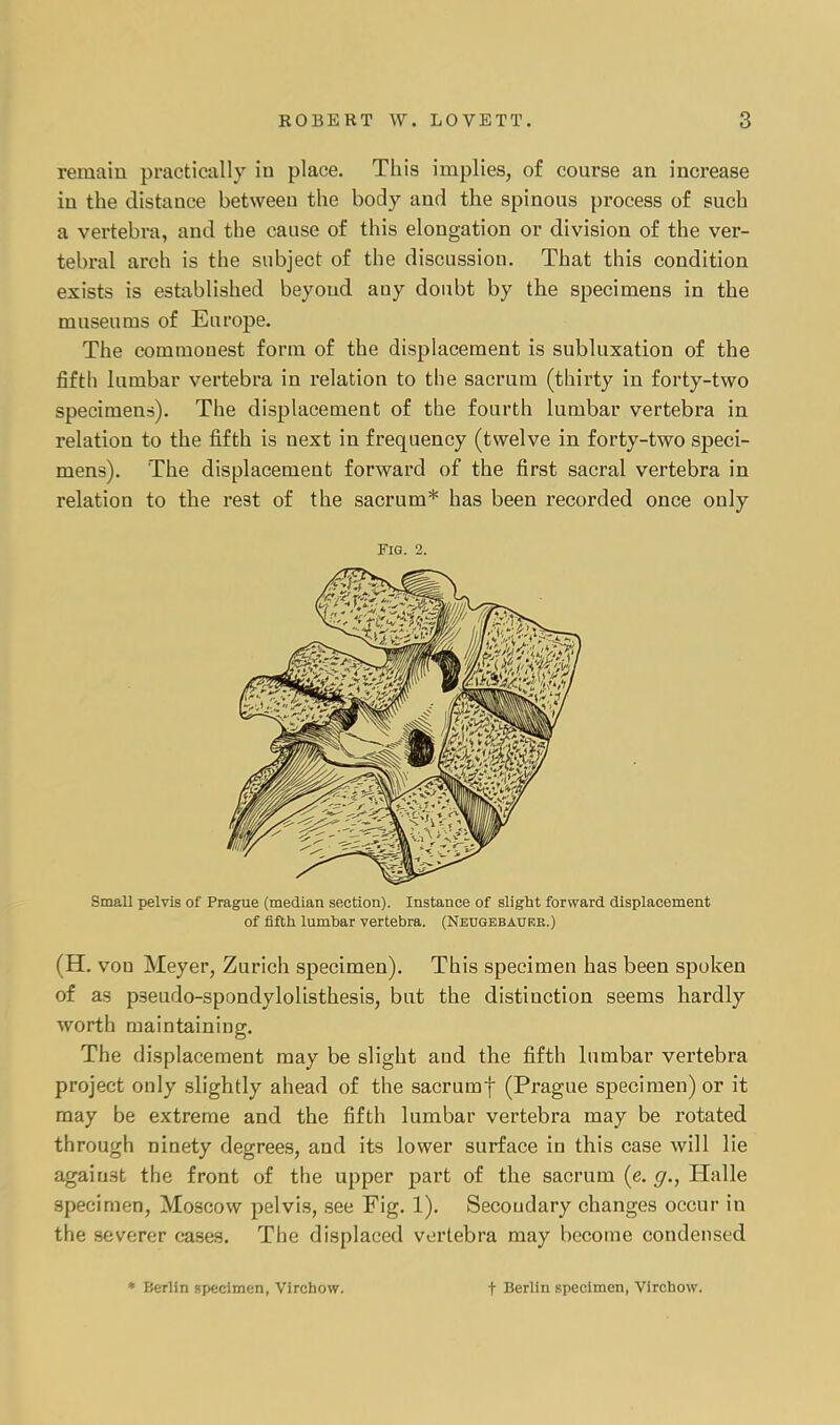 remain practically in place. This implies, of course an increase in the distance between the body and the spinous process of such a vertebra, and the cause of this elongation or division of the ver- tebral arch is the subject of the discussion. That this condition exists is established beyond any doubt by the specimens in the museums of Europe. The commonest form of the displacement is subluxation of the fifth lumbar vertebra in relation to the sacrum (thirty in forty-two specimens). The displacement of the fourth lumbar vertebra in relation to the fifth is next in frequency (twelve in forty-two speci- mens). The displacement forward of the first sacral vertebra in relation to the rest of the sacrum* has been recorded once only Fig. 2. Small pelvis of Prague (median section). Instance of slight forward displacement of fifth lumbar vertebra. (Neugebatjrr.) (H. von Meyer, Zurich specimen). This specimen has been spoken of as pseudo-spondylolisthesis, but the distinction seems hardly worth maintaining. The displacement may be slight and the fifth lumbar vertebra project only slightly ahead of the sacrumf (Prague specimen) or it may be extreme and the fifth lumbar vertebra may be rotated through ninety degrees, and its lower surface in this case will lie against the front of the upper part of the sacrum (e. g., Halle specimen, Moscow pelvis, see Fig. 1). Secondary changes occur in the severer cases. The displaced vertebra may become condensed • Berlin specimen, Virchow. t Berlin specimen, Virchow.