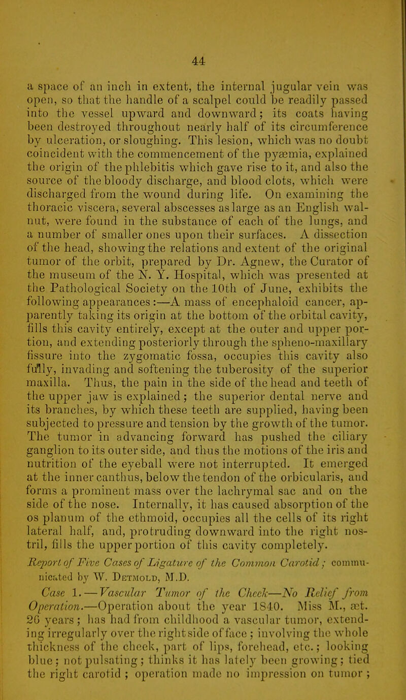 a space of an inch in extent, the internal jugular vein was open, so that the handle of a scalpel could be readily passed into the vessel upward and downward; its coats having been destroyed throughout nearly half of its circumference by ulceration, or sloughing. This lesion, which was no doubt coincident with the commencement of the pyaemia, explained the origin of the phlebitis which gave rise to it, and also the source of the bloody discharge, and blood clots, which were discharged from the wound during life. On examining the thoracic viscera, several abscesses as large as an English wal- nut, were found in the substance of each of the lungs, and a number of smaller ones upon their surfaces. A dissection of the head, showing the relations and extent of the original tumor of the orbit, prepared by Dr. Agnew, the Curator of the museum of the N. Y. Hospital, which was presented at the Pathological Society on the 10th of June, exhibits the following appearances:—Amass of encephaloid cancer, ap- parently taking its origin at the bottom of the orbital cavity, fills this cavity entirely, except at the outer and upper por- tion, and extending posteriorly through the spheno-maxillary fissure into the zygomatic fossa, occupies this cavity also fully, invading and softening the tuberosity of the superior maxilla. Thus, the pain in the side of the head and teeth of the upper jaw is explained; the superior dental nerve and its branches, by which these teeth are supplied, having been subjected to pressure and tension by the growth of the tumor. The tumor in advancing forward has pushed the ciliary ganglion to its outer side, and thus the motions of the iris and nutrition of the eyeball were not interrupted. It emerged at the inner canthus, below the tendon of the orbicularis, and forms a prominent mass over the lachrymal sac and on the side of the nose. Internally, it has caused absorption of the os planum of the ethmoid, occupies all the cells of its right lateral half, and, protruding downward into the right nos- tril, fills the upper portion of this cavity completely. Report of Five Cases of Ligature of the Common Carotid; commu- nicated by W. Detmold, M.D. Case 1. — Vascular Tumor of the Cheek—No Relief from Operation.—Operation about the year 1840. Miss M., mt. 2G years ; has had from childhood a vascular tumor, extend- ing irregularly over the right side of face ; involving the whole thickness of the cheek, part of lips, forehead, etc.; looking blue; not pulsating; thinks it has lately been growing; tied the right carotid ; operation made no impression on tumor ;