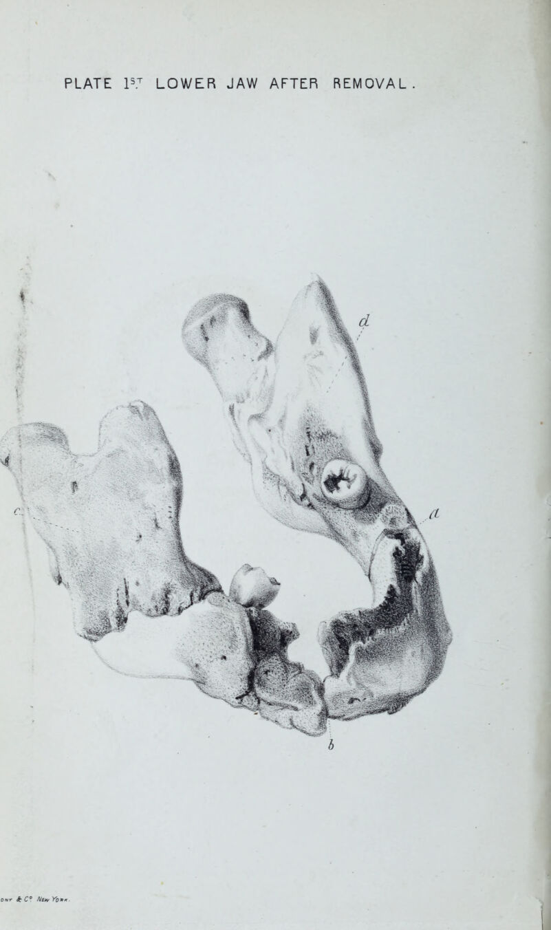 PLATE ls7 LOWER JAW AFTER REMOVAL *C° No, Yon*.