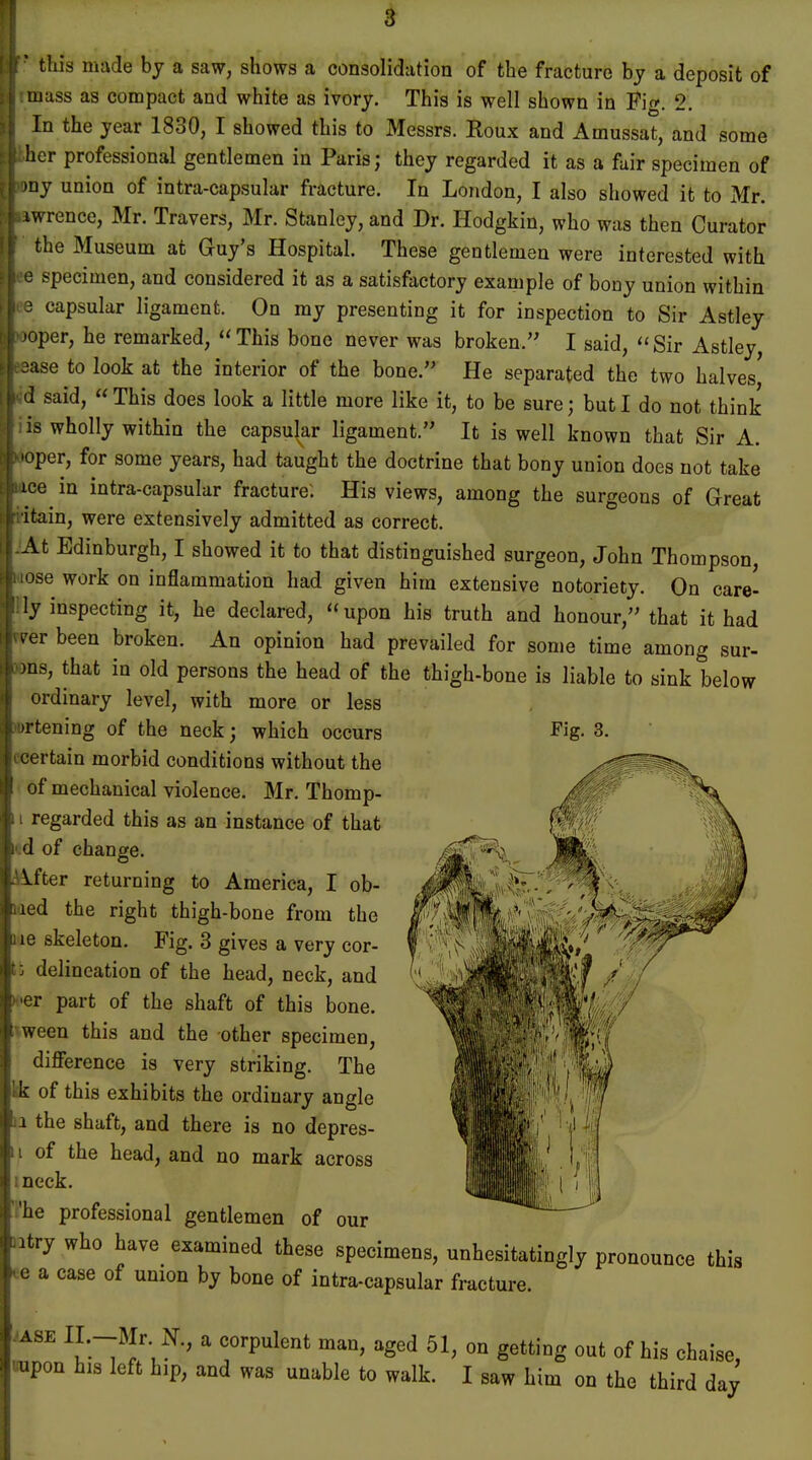 ! i r this made by a saw, shows a consolidation of the fracture by a deposit of muss as compact and white as ivory. This is well shown in Pig. 2. In the year 1830, I showed this to Messrs. Roux and Amussat, and some pher professional gentlemen in Paris; they regarded it as a fair specimen of ' my union of intracapsular fracture. In London, I also showed it to Mr. .iwrence, Mr. Travers, Mr. Stanley, and Dr. Hodgkin, who was then Curator the Museum at Guy's Hospital. These gentlemen were interested with ■e specimen, and considered it as a satisfactory example of bony union within 3 capsular ligament. On my presenting it for inspection to Sir Astley >oper, he remarked, This bone never was broken, I said, Sir Astley, ease to look at the interior of the bone. He separated the two halves' said,  This does look a little more like it, to be sure ; but I do not think iis wholly within the capsular ligament. It is well known that Sir A. •oper, for some years, had taught the doctrine that bony union does not take me^ in intra-capsular fracture: His views, among the surgeons of Great ritain, were extensively admitted as correct. At Edinburgh, I showed it to that distinguished surgeon, John Thompson, iose work on inflammation had given him extensive notoriety. On care- ' ly inspecting it, he declared, upon his truth and honour, that it had eer been broken. An opinion had prevailed for some time among sur- ros, that in old persons the head of the thigh-bone is liable to sink below ordinary level, with more or less urtening of the neck; which occurs certain morbid conditions without the of mechanical violence. Mr. Thomp- i regarded this as an instance of that k'.d of change. ^Ifter returning to America, I ob- n.ied the right thigh-bone from the hie skeleton. Fig. 3 gives a very cor- t; delineation of the head, neck, and liMer part of the shaft of this bone, pween this and the other specimen, difference is very striking. The k of this exhibits the ordinary angle b the shaft, and there is no depres- h of the head, and no mark across neck. [he professional gentlemen of our tatty who have examined these specimens, unhesitatingly pronounce this |ea case of union by bone of intra-capsular fracture. Lase IL-Mr 4, a corpulent man, aged 51, on getting out of his chaise, rapon his left hip, and was unable to walk. I saw him on the third day :