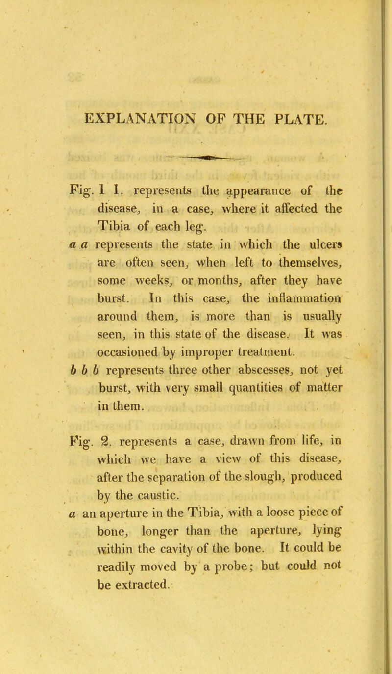 EXPLANATION OF THE PLATE. Fig. 1 1. represents the appearance of the disease, in a case, where it affected the Tibia of each leg. a a represents the state in which the ulcers are often seen, when left to themselves, some weeks, or months, after they have burst. In this case, the inflammation around them, is more than is usually seen, in this state of the disease. It was occasioned by improper treatment. b b b represents three other abscesses, not yet burst, with very small quantities of matter in them. Kg-. 2. represents a case, drawn from life, in which we have a view of this disease, after the separation of the slough, produced by the caustic. a an aperture in the Tibia, with a loose piece ot bone, longer than the aperture, lying within the cavity of the bone. It could be readily moved by a probe; but could not be extracted.