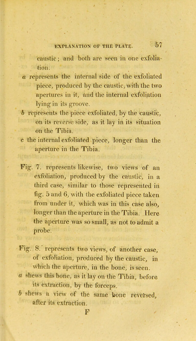 / EXPLANATION OF THE PLATE. 5? caustic; arid both are seen in one exfolia- tion. a represents the internal side of the exfoliated piece., produced by the caustic,, with the two apertures in it, and the internal exfoliation lying-in its groove. b represents the piece exfoliated, by the caustic, on its reverse side, as it lay in its situation on the Tibia. c the internal exfoliated piece, longer than the aperture in the Tibia. Fig. 7. represents likewise, two views of an exfoliation, produced by the caustic, in a third case, similar to those represented in fig. 5 and 6, with the exfoliated piece taken from under it, which was in this case also, longer than the aperture in the Tibia. Here the aperture was so small, as not to admit a probe. Fig. 8. represents two views, of another case, of exfoliation, produced by the caustic, in which the aperture, in the bone, is seen. a shews this bone, as it lay on the Tibia, before its extraction, by the forceps. b shews a view of the same bone reversed, after its extraction. F