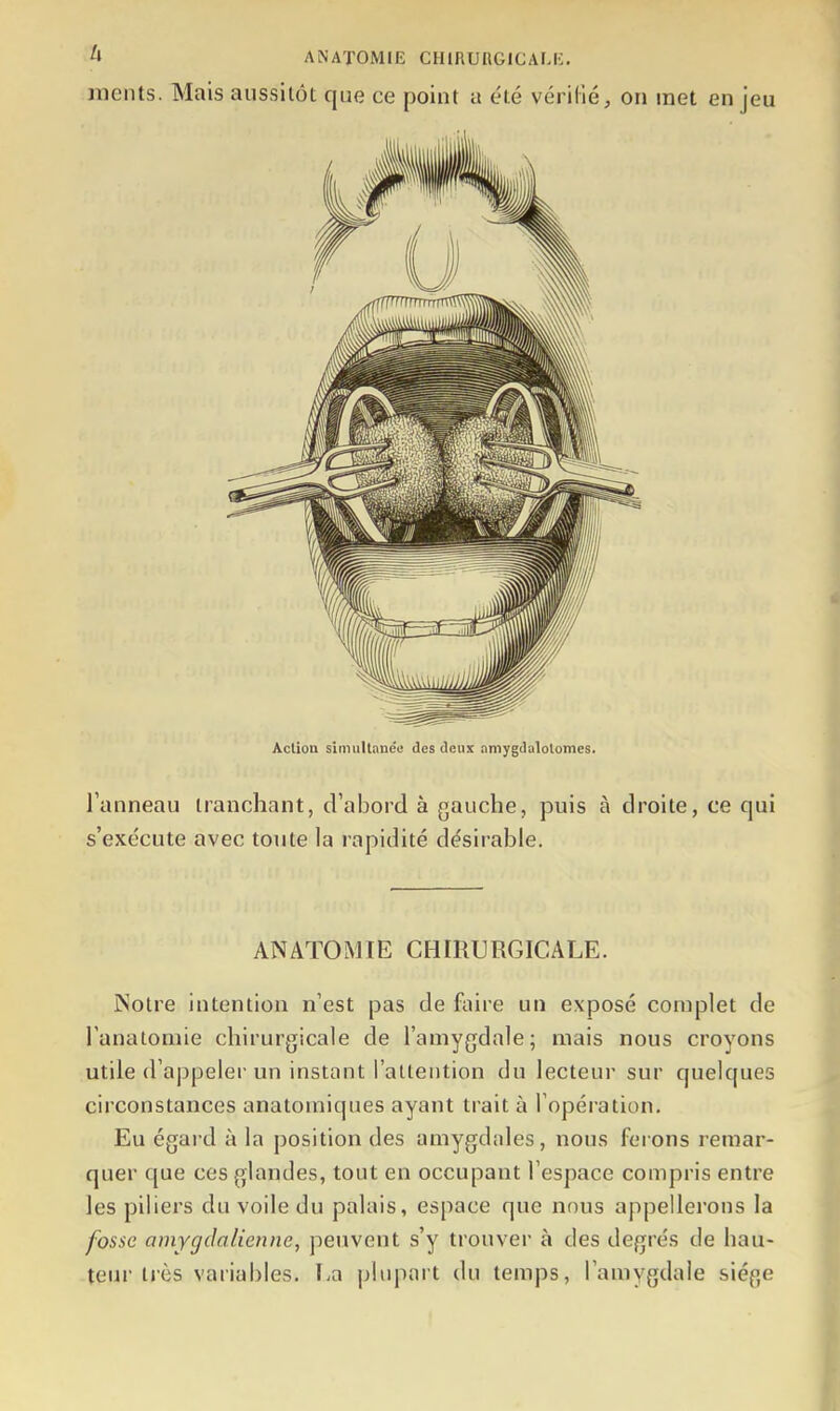 Jïients. Mais aussitôt que ce point a été vérillé, on met en jeu Action simultanée des deux amygdalolomes. l'anneau tranchant, d'abord à gauche, puis à droite, ce qui s'exécute avec toute la rapidité désirable. ANATOMIE CHIRURGICALE. ISotre intention n'est pas de faire un exposé complet de l'anatoniie chirurgicale de l'amygdale; mais nous croyons utile d'appeler un instant l'attention du lecteur sur quelques circonstances anatomiques ayant trait à l'opération. Eu égard à la position des amygdales, nous ferons remar- quer que ces glandes, tout en occupant l'espace compris entre les piliers du voile du palais, espace que nous appellerons la fosse amygclalienne, peuvent s'y trouver à des degrés de hau- teur très variables. La phqiart du temps, l'amygdale siège