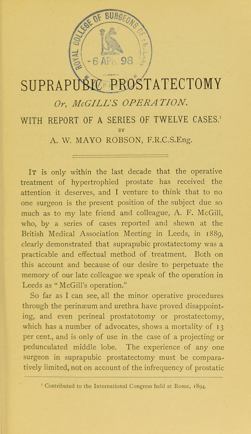 Or, McGILLS OPERATION. WITH REPORT OF A SERIES OF TWELVE CASES.^ BY A. W. MAYO ROBSON, F.R.C.S.Eng. It is only within the last decade that the operative treatment of hypertrophied prostate has received the attention it deserves, and I venture to think that to no one surgeon is the present position of the subject due so much as to my late friend and colleague, A. F. McGill, who, by a series of cases reported and shewn at the British Medical Association Meeting in Leeds, in 1889, clearly demonstrated that suprapubic prostatectomy was a practicable and effectual method of treatment. Both on this account and because of our desire to perpetuate the memory of our late colleague we speak of the operation in Leeds as  McGill's operation. So far as I can see, all the minor operative procedures through the perinaeum and urethra have proved disappoint- ing, and even perineal prostatotomy or prostatectomy, which has a number of advocates, shows a mortality of 13 per cent., and is only of use in . the case of a projecting or pedunculated middle lobe. The experience of any one surgeon in suprapubic prostatectomy must be compara- tively limited, not on account of the infrequency of prostatic ' Conlribuled to the International Congress held at Rome, 1894.