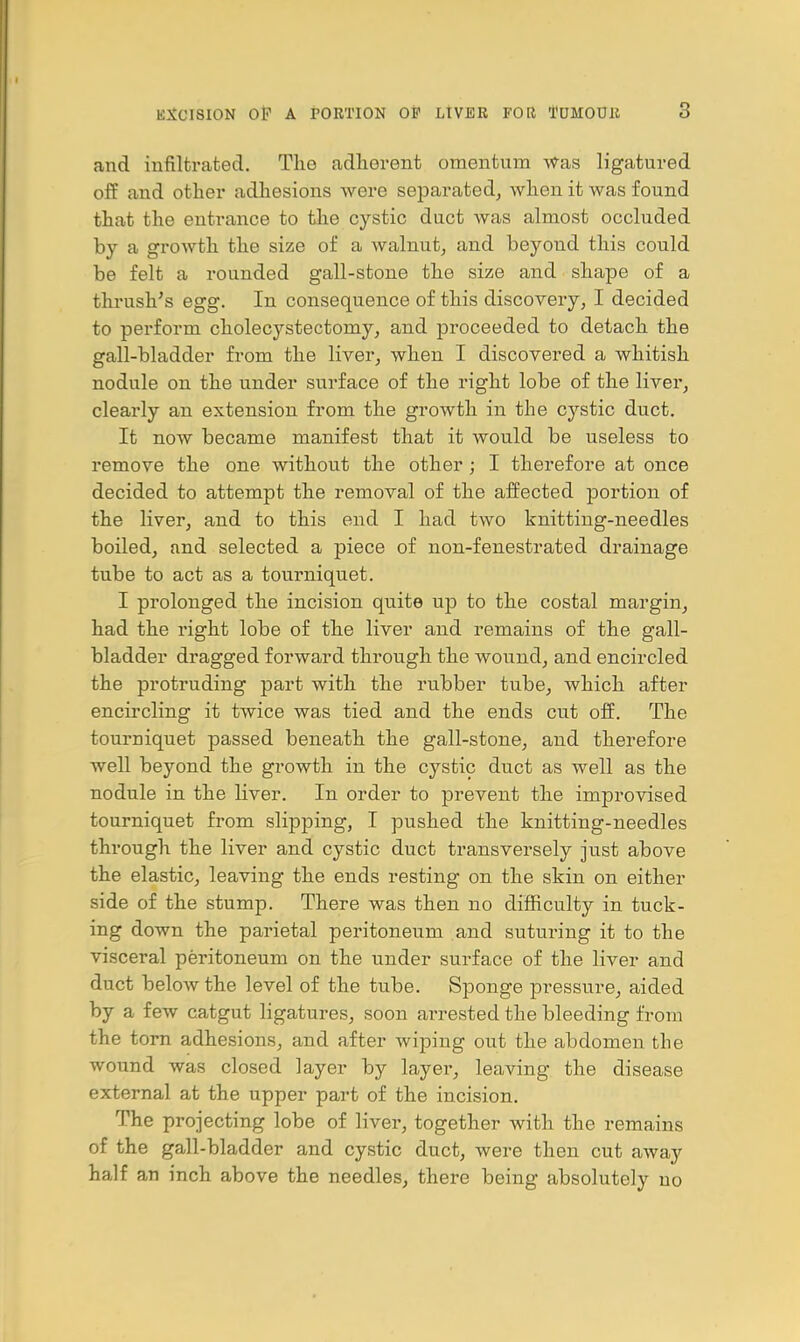 and iufiltrated. The adherent omentum Was ligatured off and other adhesions were separated^ when it was found that the entrance to the cystic duct was almost occluded by a growth the size of a walnut^ and beyond this could be felt a rounded gall-stone the size and shape of a thrush's egg. In consequence of this discovery, I decided to perform cholecystectomy, and proceeded to detach the gall-bladder from the liver, when I discovered a whitish nodule on the under surface of the right lobe of the liver, clearly an extension from the growth in the cystic duct. It now became manifest that it would be useless to remove the one without the other ; I therefore at once decided to attempt the removal of the affected portion of the liver, and to this end I had two knitting-needles boiled, and selected a piece of non-fenestrated drainage tube to act as a tourniquet. I prolonged the incision quite up to the costal margin, had the right lobe of the liver and remains of the gall- bladder dragged forward through the wound, and encircled the protruding part with the rubber tube, which after encircling it twice was tied and the ends cut off. The tourniquet passed beneath the gall-stone, and therefore well beyond the growth in the cystic duct as well as the nodule in the Kver. In order to prevent the improvised tourniquet from slipping, I pushed the knitting-needles through the liver and cystic duct transversely just above the elastic, leaving the ends resting on the skin on either side of the stump. There was then no difficulty in tuck- ing down the parietal peritoneum and suturing it to the visceral peritoneum on the under surface of the liver and duct below the level of the tube. Sponge pressure^ aided by a few catgut ligatures, soon arrested the bleeding from the torn adhesions, and after wiping out the abdomen the wound was closed layer by layer, leaving the disease external at the upper part of the incision. The projecting lobe of liver, together with the remains of the gall-bladder and cystic duct, were then cut away half an inch above the needles^ there being absolutely no