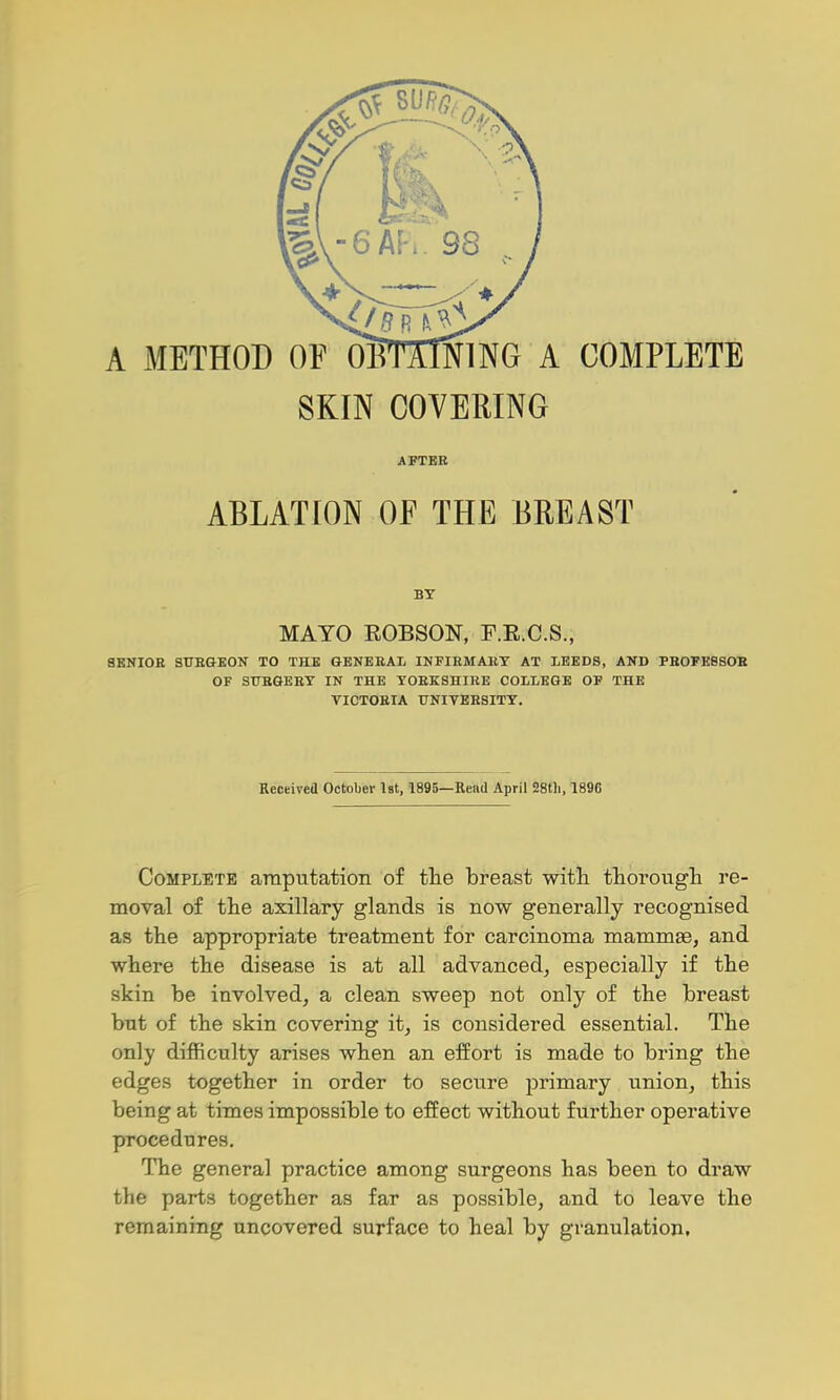 SKIN COVERING AFTER ABLATION OF THE BREAST BT MAYO EOBSON, F.E.C.S., SBKIOE 8TJBGK0N TO THE GENERAL INFIRMARY AT LEEDS, AND PB0FE8S0B OF SUBGEET IN THE YORKSHIRE COLLEGE OF THE VICTORIA UNIVEESITY. Received October Ist, 1895—Rend April 28tli, 1896 Complete araputation of the breast with thorough re- moval of the axillary glands is now generally recognised as the appropriate treatment for carcinoma mammae, and where the disease is at all advanced, especially if the skin be involved, a clean sweep not only of the breast bnt of the skin covering it, is considered essential. The only difficulty arises when an effort is made to bring the edges together in order to secure jirimary union, this being at times impossible to effect without further operative procedures. The general practice among surgeons has been to draw the parts together as far as possible, and to leave the remaining uncovered surface to heal by granulation.