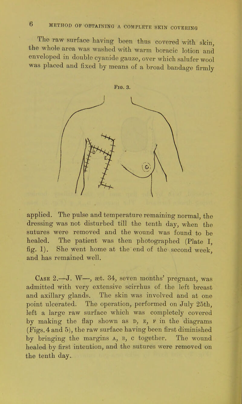 The raw surface having been thus covered with skin, the whole area was washed with warm boracic lotion and enveloped in double cyanide gauze, over which salufer wool was placed and fixed by means of a broad bandage firmly Pig. 3. applied. The pulse and temperature remaining normal, the dressing was not disturbed till the tenth day, when the sutures were removed and the wound was found to be healed. The patient was then photographed (Plate I, fig. 1). She went home at the end of the second week, and has remained well. Case 2.—J. W—, aet. 34, seven months' pregnant, was admitted with very extensive scirrhus of the left breast and axillary glands. The skin was involved and at one point ulcerated. The operation, performed on July 25th, left a large raw surface which was completely covered by making the flap shown as D, e, p in the diagrams (Figs. 4 and 5), the raw surface having been first diminished by bringing the margins a, b, c together. The wound healed by first intention, and the sutures were removed on the tenth day.