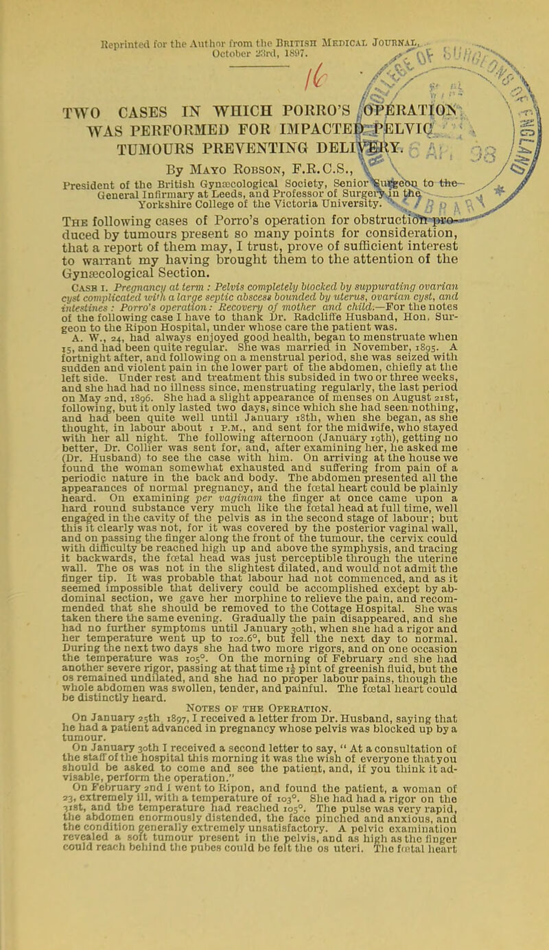 Reprinted for the Author from the DRmsn Medical Journal,,.. October 2;!ra, 1897. ^^^V '^'-'/iV 1^' / ! '' TWO CASES IN WHICH POIIRO'S |((^jERATiQlS : WAS PERFORMED FOR IMPACTEfe^LVia ; TUMOURS PREVENTING DELI9MY. 5 /^j,^ By Mayo Robson, F.R.C.S., President of the Bi-itish Gynajcological Society, Senior\ui^ebQ^to the- General Infirmary at Leeds, and Professor of SurgeiTjn tha ■ Yorkshire College of the Victoria University. / .'y p <^ C\ The following cases of Porro's operation for obstructi5ll''pss.- duced by tumours present so many points for consideration, that a report of them may, I trust, prove of sufficient interest to waiTant my having brought them to the attention of the Gynaecological Section. Casb I. Pregnane!/ at term : Pelvis completely blocked by suppurating ovarian cyst complicated iviOi a large septic abscess bounded by utenis, ovarian cyst, and intestines: Porro's operation: Recovery of mother and c/«7cZ.—For the notes of the following case I have to thank L>r. RadcUffe Husband, Hon, Sur- geon to the Kipon Hospital, under whose care the patient was. A. W., 24, had always enjoyed good health, began to menstruate when J5, and had been quite regular. She was married in November, 1895. A fortnight after, and following ou a menstrual period, she was seized with sudden and violent pain in the lower part of the abdomen, chiefly at tlie left side. Under rest and treatment this subsided in two or three weeks, and she had had no illness since, menstruating regularly, the last period on May 2nd, 1896. She had a slight appearance of menses on August 2ist, following, but it only lasted two days, since which she had seen nothing, and had been quite well until January i8th, when she began, as she thought, in labour about i p.m., and sent for the midwife, who stayed with her aU night. The following afternoon (January 19th), getting no better. Dr. Collier was sent for, and, after examining her, he asked me (Dr. Husband) to see the case with him. On arriving at the house we found the woman somewhat exhausted and suffering from pain of a periodic nature in the back and body. The abdomen presented all the appearances of normal pregnancy, and the foetal heart could be plainly heard. On examining per vaginam the finger at once came upon a hard round substance very much like the foetal head at full time, well engaged in the cavity of the pelvis as in the second stage of labour; but this it clearly was not, for it was covered by the posterior vaginal wall, and on passing the finger along the front of the tumour, the cervix could with difficulty be reached high up and above the symphysis, and tracing it backwards, the fcetal head was just perceptible through the uterine wall. The os was not in the slightest dilated, and would not admit the finger tip. It was probable that labour had not commenced, and as it seemed impossible that delivery could be accomplished except by ab- dominal section, we gave her morphine to relieve the pain, and recom- mended that she should be removed to the Cottage Hospital. She was taken there the same evening. Gradually the pain disappeared, and slie had no further symptoms until January 30th, when she had a rigor and her temperature went up to 102.6°, but fell the next day to normal. During the next two days she had two more rigors, and on one occasion the temperature was 105°. On the morning of February 2nd she had another severe rigor, passing at that time 15 pint of greenish fluid, but the OS remained undilated, and she had no proper labour pains, though the whole abdomen was swollen, tender, and painful. The fcetal heart could be distinctly heard. Notes of the Opehation. On January 25th 1897,1 received a letter from Dr. Husband, saying that he had a patient advanced in pregnancy whose pelvis was blocked up by a tumour. On January 30th I received a second letter to say,  At a consultation of the staff of the hospital this morning it was the wish of everyone thatyou should be asked to come and see the patient, and, if you tliink it ad- visable, perform the operation. On February 2nd 1 went to Kipon, and found the patient, a woman of 23, extremely ill, with a temperature of 103°. She had had a rigor on the 3J8t, and the temperature had readied 105°. The pulse was very rapid, tlie abdomen enormously distended, the face pinched and anxious, and the condition generally extremely unsatisfactory. A pelvic examination revealed a soft tumour present in tlie pelvis, and as high as the linger could reach behind the puhes could be felt the os uteri. The fdital heart