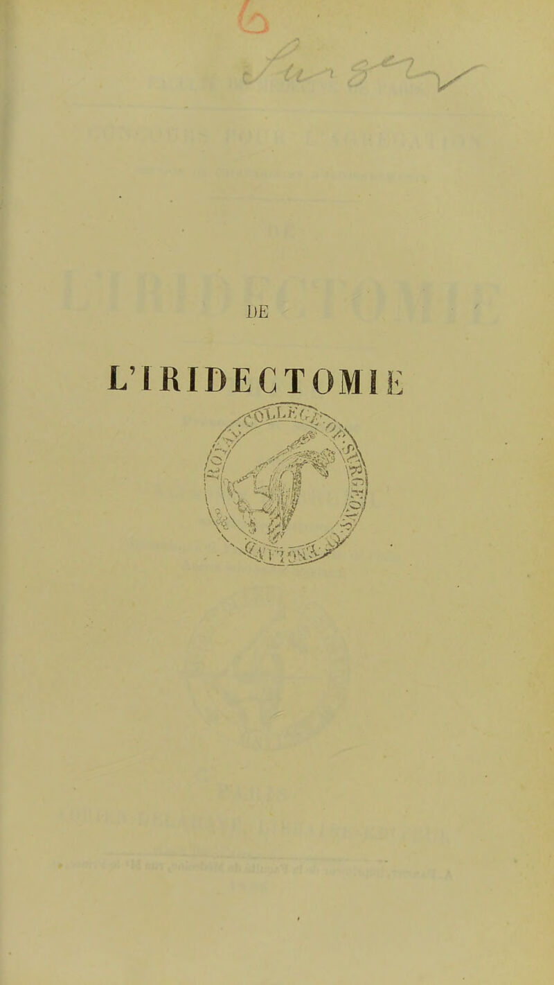 i)E L'IRIDECTOMIE i