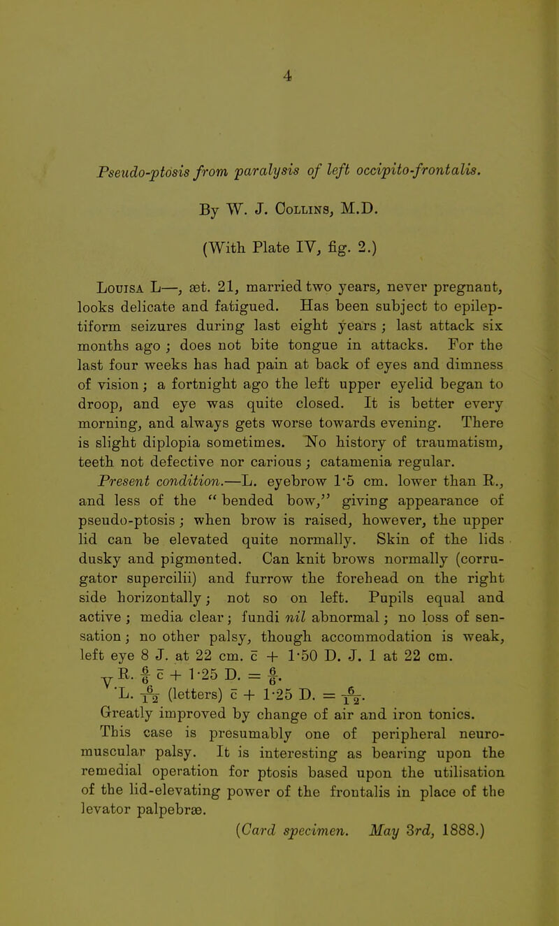 Pseado-ptosis from paralysis of left occipito-frontalis. By W. J. Collins, M.D. (With Plate IV, fig. 2.) Louisa L—, set. 21, married two years, never pregnant, looks delicate and fatigued. Has been subject to epilep- tiform seizures during last eight years ; last attack six months ago ; does not bite tongue in attacks. For the last four weeks has had pain at back of eyes and dimness of vision; a fortnight ago the left upper eyelid began to droop, and eye was quite closed. It is better every morning, and always gets worse towards evening. There is slight diplopia sometimes. No history of traumatism, teeth not defective nor carious; catamenia regular. Present condition.—L. eyebrow 1*5 cm. lower than R., and less of the  bended bow, giving appearance of pseudo-ptosis; when brow is raised, however, the upper lid can be elevated quite normally. Skin of the lids dusky and pigmented. Can knit brows normally (corru- gator supercilii) and furrow the forehead on the right side horizontally; not so on left. Pupils equal and active; media clear; fundi nil abnormal; no loss of sen- sation ; no other palsy, though accommodation is weak, left eye 8 J. at 22 cm. c + 1'50 D. J. 1 at 22 cm. yE. f c + 1-25 D. = f. 'L. ^ (letters) c + 1-25 D. == Greatly improved by change of air and iron tonics. This case is presumably one of peripheral neuro- muscular palsy. It is interesting as bearing upon the remedial operation for ptosis based upon the utilisation of the lid-elevating power of the frontalis in place of the levator palpebrsB.