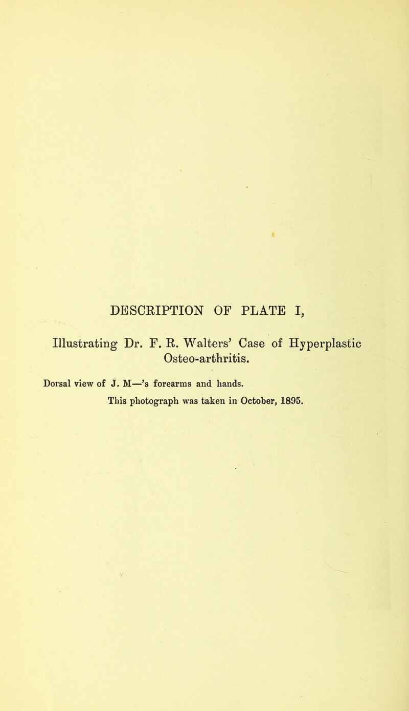 Illustrating Dr. F. R. Walters’ Case of Hyperplastic Osteo-arthritis. Dorsal view of J. M—’s forearms and hands. This photograph was taken in October, 1895.