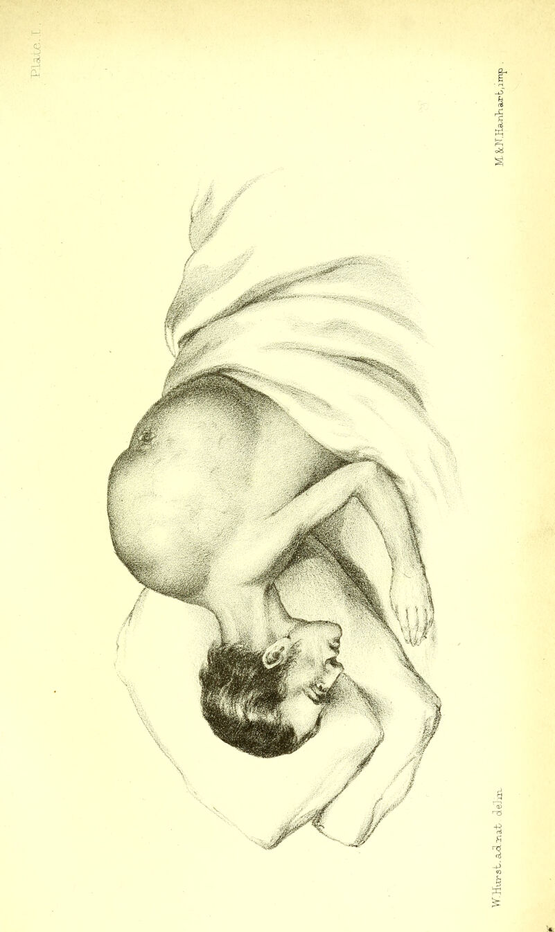 •S W.Hurst, a<3.-inat (leJni- M. 8cNJia.ri}-Lart,imp