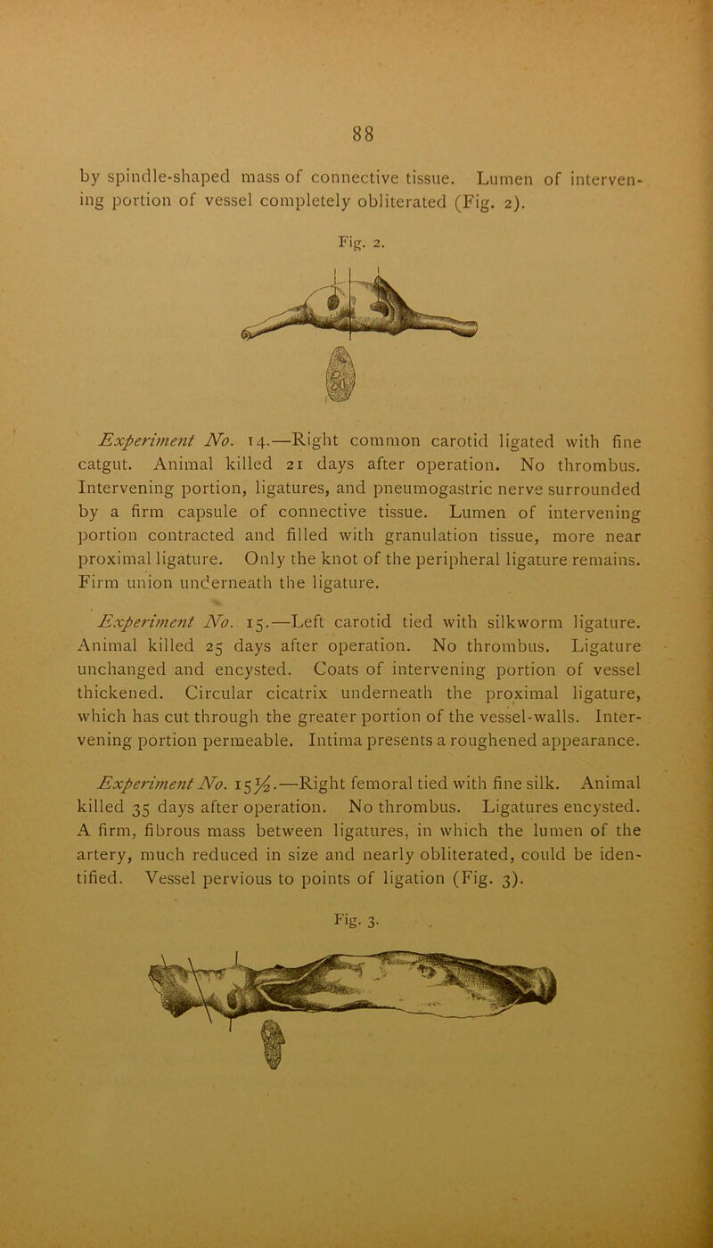 by spindle-shaped mass of connective tissue. Lumen of interven- ing portion of vessel completely obliterated (Fig. 2). Experiment No. 14.—Right common carotid ligated with fine catgut. Animal killed 21 days after operation. No thrombus. Intervening portion, ligatures, and pneumogastric nerve surrounded by a firm capsule of connective tissue. Lumen of intervening portion contracted and filled with granulation tissue, more near proximal ligature. Only the knot of the peripheral ligature remains. Firm union underneath the ligature. Experiment No. 15.—Left carotid tied with silkworm ligature. Animal killed 25 days after operation. No thrombus. Ligature unchanged and encysted. Coats of intervening portion of vessel thickened. Circular cicatrix underneath the proximal ligature, which has cut through the greater portion of the vessel-walls. Inter- vening portion permeable. Intima presents a roughened appearance. Experiment No. 15^4.—Right femoral tied with fine silk. Animal killed 35 days after operation. No thrombus. Ligatures encysted. A firm, fibrous mass between ligatures, in which the lumen of the artery, much reduced in size and nearly obliterated, could be iden- tified. Vessel pervious to points of ligation (Fig. 3). Fig. 2.
