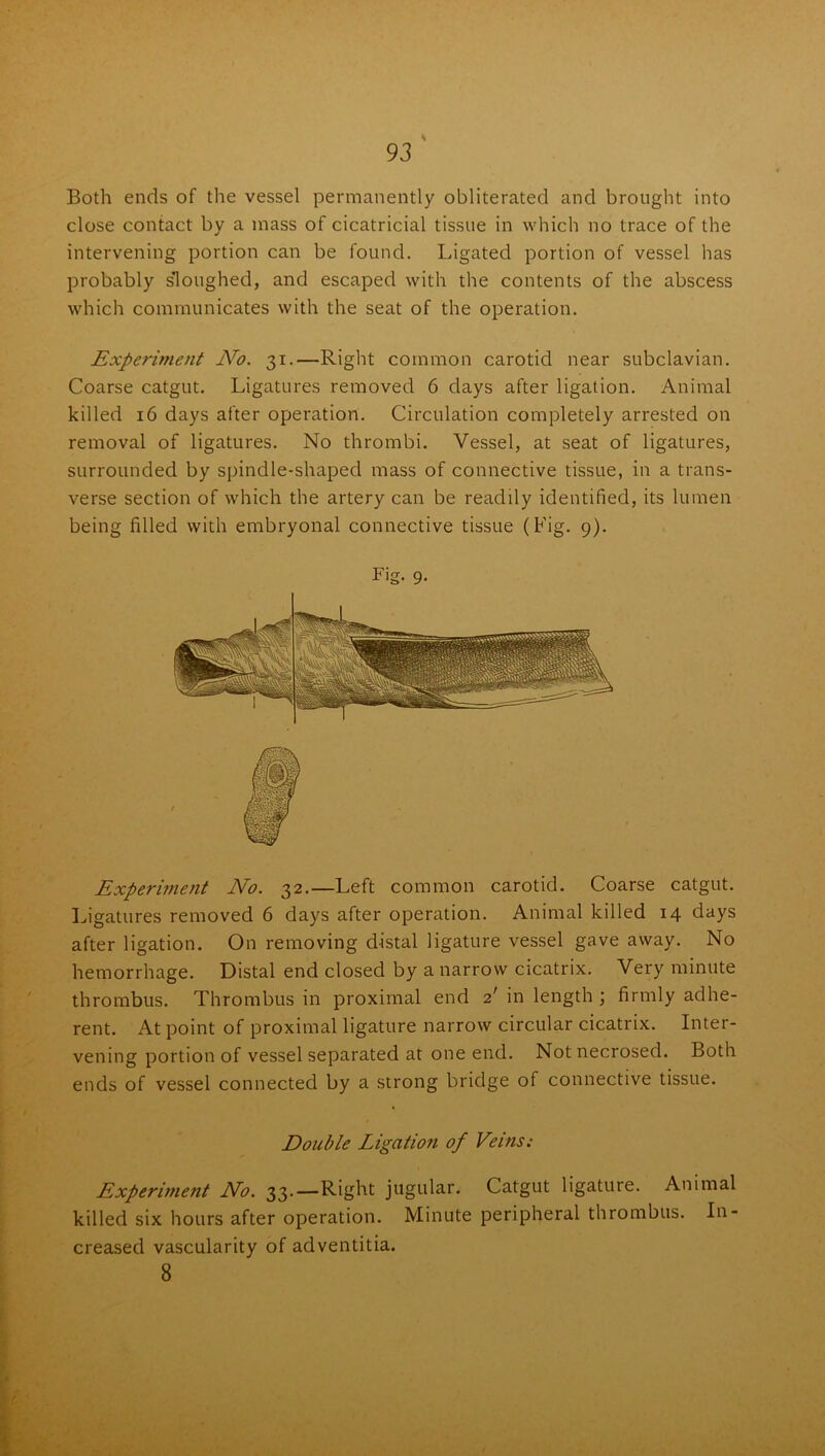 Both ends of the vessel permanently obliterated and brought into close contact by a mass of cicatricial tissue in which no trace of the intervening portion can be found. Ligated portion of vessel has probably sloughed, and escaped with the contents of the abscess which communicates with the seat of the operation. Experiment No. 31.—Right common carotid near subclavian. Coarse catgut. Ligatures removed 6 days after ligation. Animal killed 16 days after operation. Circulation completely arrested on removal of ligatures. No thrombi. Vessel, at seat of ligatures, surrounded by spindle-shaped mass of connective tissue, in a trans- verse section of which the artery can be readily identified, its lumen being filled with embryonal connective tissue (Fig. 9). Fig. 9. Experunent No. 32.—Left common carotid. Coarse catgut. Ligatures removed 6 days after operation. Animal killed 14 days after ligation. On removing distal ligature vessel gave away. No hemorrhage. Distal end closed by a narrow cicatrix. Very minute thrombus. Thrombus in proximal end 2' in length ; firmly adhe- rent. At point of proximal ligature narrow circular cicatrix. Inter- vening portion of vessel separated at one end. Not necrosed. Both ends of vessel connected by a strong bridge of connective tissue. Doable Ligation of Veins: Experiment No. 33.—Right jugular. Catgut ligature. Animal killed six hours after operation. Minute peripheral thrombus. In- creased vascularity of adventitia. 8