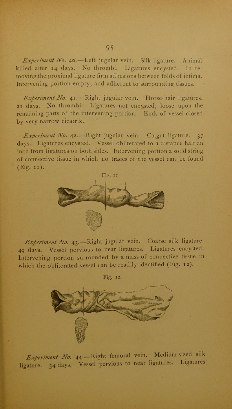 Experiment No. 40.—Left jugular vein. Silk ligature. Animal killed after 14 days. No thrombi. Ligatures encysted. In re- moving the proximal ligature firm adhesions between folds of intima. Intervening portion empty, and adherent to surrounding tissues. Experiment No. 41.—Right jugular vein. Horse hair ligatures. 21 days. No thrombi. Ligatures not encjjsted, loose upon the remaining parts of the intervening portion. Ends of vessel closed by very narrow cicatrix. Experime?it No. 42. — Right jugular vein. Catgut ligature. 37 days. Ligatures encysted. Vessel obliterated to a distance half an inch from ligatures on both sides. Intervening portion a solid string of connective tissue in which no traces of the vessel can be found (Eig. n). Fig. 11. Experime?it No. 43.—Right jugular vein. Coarse silk ligature. 49 days. Vessel pervious to near ligatures. Ligatures encysted. Intervening portion surrounded by a mass of connective tissue in which the obliterated vessel can be readily identified (fig. 12). Fig. 12. Experiment No. 44--Right femoral vein. Medium-sized silk ligature. 54 days. Vessel pervious to near ligatures. Ligatures