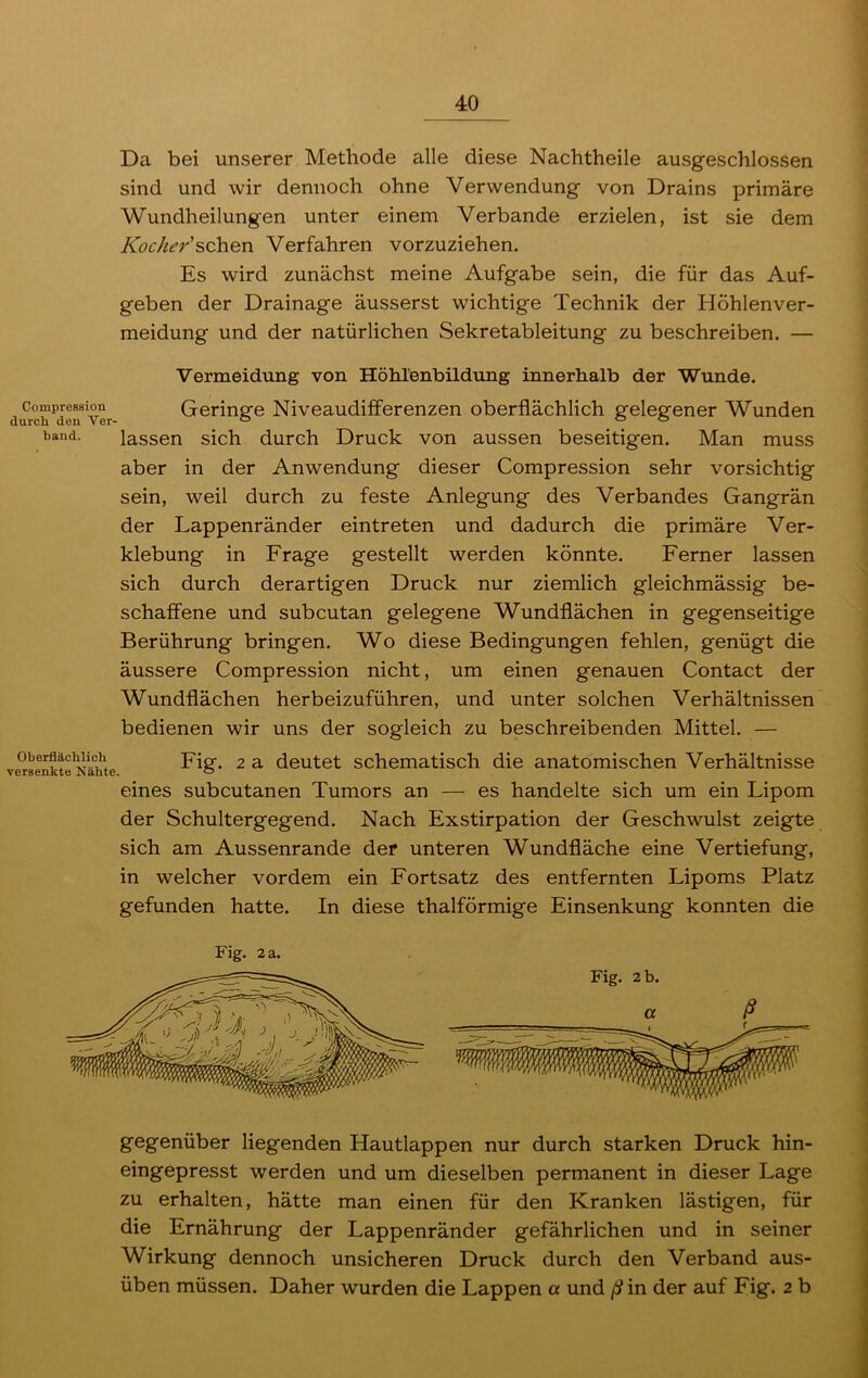 Da bei unserer Methode alle diese Nachtheile ausgeschlossen sind und wir dennoch ohne Verwendung von Drains primäre Wundheilungen unter einem Verbände erzielen, ist sie dem Kocher'sehen Verfahren vorzuziehen. Es wird zunächst meine Aufgabe sein, die für das Auf- geben der Drainage äusserst wichtige Technik der Höhlenver- meidung und der natürlichen Sekretableitung zu beschreiben. — Vermeidung von Höhlenbildung innerhalb der Wunde. Compression durch den Ver- band. Oberflächlich versenkte Nähte. Geringe Niveaudifferenzen oberflächlich gelegener Wunden lassen sich durch Druck von aussen beseitigen. Man muss aber in der Anwendung dieser Compression sehr vorsichtig sein, weil durch zu feste Anlegung des Verbandes Gangrän der Lappenränder eintreten und dadurch die primäre Ver- klebung in Frage gestellt werden könnte. Ferner lassen sich durch derartigen Druck nur ziemlich gleichmässig be- schaffene und subcutan gelegene Wundflächen in gegenseitige Berührung bringen. Wo diese Bedingungen fehlen, genügt die äussere Compression nicht, um einen genauen Contact der Wundflächen herbeizuführen, und unter solchen Verhältnissen bedienen wir uns der sogleich zu beschreibenden Mittel. — Fig. 2 a deutet schematisch die anatomischen Verhältnisse eines subcutanen Tumors an — es handelte sich um ein Lipom der Schultergegend. Nach Exstirpation der Geschwulst zeigte sich am Aussenrande der unteren Wundfläche eine Vertiefung, in welcher vordem ein Fortsatz des entfernten Lipoms Platz gefunden hatte. In diese thalförmige Einsenkung konnten die Fig. 2 a. Fig. 2 b. gegenüber liegenden Hautlappen nur durch starken Druck hin- eingepresst werden und um dieselben permanent in dieser Lage zu erhalten, hätte man einen für den Kranken lästigen, für die Ernährung der Lappenränder gefährlichen und in seiner Wirkung dennoch unsicheren Druck durch den Verband aus- üben müssen. Daher wurden die Lappen a und ß in der auf Fig. 2 b