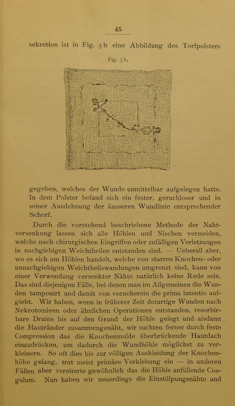 Sekretion ist in Fig. 5 b eine Abbildung des Torfpolsters Fig. 5 b. gegeben, welches der Wunde unmittelbar aufgelegen hatte. In dem Polster befand sich ein fester, geruchloser und in seiner Ausdehnung der äusseren Wundlinie entsprechender Schorf. Durch die vorstehend beschriebene Methode der Naht- versenkung lassen sich alle Höhlen und Nischen vermeiden, welche nach chirurgischen Eingriffen oder zufälligen Verletzungen in nachgiebigen Weichtheilen entstanden sind. — Ueberall aber, wo es sich um Höhlen handelt, welche von starren Knochen- oder unnachgiebigen WeichtheilsWandungen umgrenzt sind, kann von einer Verwendung versenkter Nähte natürlich keine Rede sein. Das sind diejenigen Fälle, bei denen man im Allgemeinen die Wun- den tamponirt und damit von vorneherein die prima intentio auf- giebt. Wir haben, wenn in früherer Zeit derartige Wunden nach Nekrotomieen oder ähnlichen Operationen entstanden, resorbir- bare Drains bis auf den Grund der Höhle gelegt und alsdann die Hautränder zusammengenäht, wir suchten ferner durch feste Compression das die Knochenmulde überbrückende Hautdach einzudrücken, um dadurch die Wundhöhle möglichst zu ver- kleinern. So oft dies bis zur völligen Auskleidung der Knochen- höhe gelang, trat meist primäre Verklebung ein — in anderen Fällen aber vereiterte gewöhnlich das die Höhle anfüllende Coa- gulum. Nun haben wir neuerdings die Einstülpungsnähte und