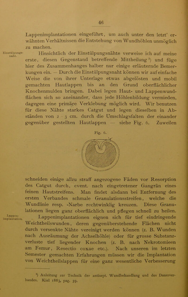 Kinstttlpungs- nalit. Lappen- implautation. Lappenimplantationen eingeführt, um auch unter den letzt’ er- wähnten Verhältnissen die Entstehung von Wundhöhlen unmöglich zu machen. Hinsichtlich der Einstülpungsnähte verweise ich auf meine erste, diesen Gegenstand betreffende Mittheilung1) und füge hier des Zusammenhanges halber nur einige erläuternde Bemer- kungen ein. — Durch die Einstülpungsnaht können wir auf einfache Weise die von ihrer Unterlage etwas abgelösten und mobil gemachten Hautlappen bis an den Grund oberflächlicher Knochenmulden bringen. Dabei legen Haut- und Lappenwund- flächen sich so aneinander, dass jede Höhlenbildung vermieden, dagegen eine primäre Verklebung möglich wird. Wir benutzen für diese Nähte starkes Catgut und legen dieselben in Ab- ständen von 2-3 cm. durch die Umschlagsfalten der einander gegenüber gestellten Hautlappen — siehe Fig. 6. Zuweilen Fig. 6. schneiden einige allzu straff angezogene Fäden vor Resorption des Catgut durch, event. nach eingetretener Gangrän eines feinen Hautstreifens. Man findet alsdann bei Entfernung des ersten Verbandes schmale Granulationsstreifen, welche die Wundlinie resp. -Narbe rechtwinklig kreuzen. Diese Granu- lationen liegen ganz oberflächlich und pflegen schnell zu heilen. Lappenimplantationen eignen sich für tief eindringende Weichtheilswunden, deren gegenüberstehende Flächen nicht durch versenkte Nähte vereinigt werden können (z. B. Wunden nach Ausräumung der Achselhöhle) oder für grosse Substanz- verluste tief liegender Knochen (z. B. nach Nekrotomieen am Femur, Resectio coxae etc.). Nach unseren im letzten Semester gemachten Erfahrungen müssen wir die Implantation von Weichtheilslappen für eine ganz wesentliche Verbesserung l) Anleitung zur Technik der antisept. Wundbehandlung und des Dauerver- bandes, Kiel 1883, pag. 39.