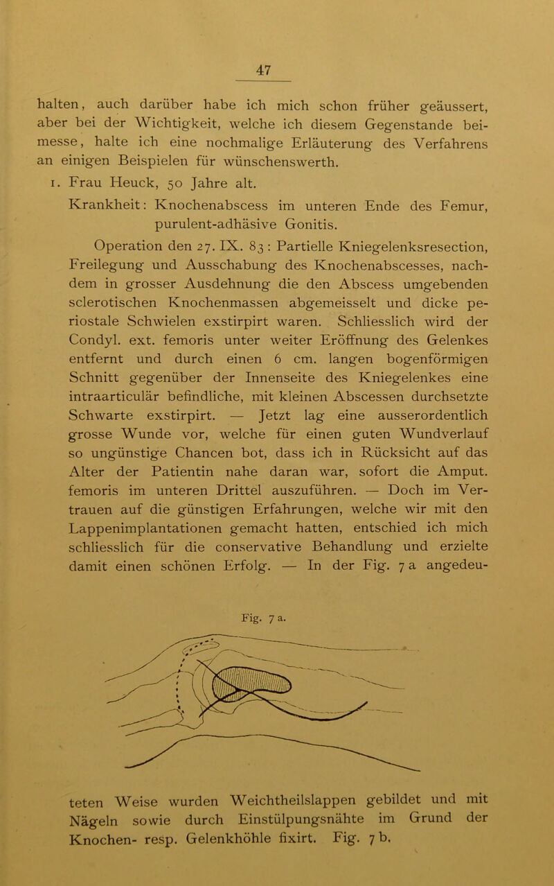 halten, auch darüber habe ich mich schon früher geäussert, aber bei der Wichtigkeit, welche ich diesem Gegenstände bei- messe, halte ich eine nochmalige Erläuterung des Verfahrens an einigen Beispielen für wünschenswerth. i. Frau Heuck, 50 Jahre alt. Krankheit: Knochenabscess im unteren Ende des Femur, purulent-adhäsive Gonitis. Operation den 27. IX. 83 : Partielle Kniegelenksresection, Freilegung und Ausschabung des Knochenabscesses, nach- dem in grosser Ausdehnung die den iVbscess umgebenden sclerotischen Knochenmassen abgemeisselt und dicke pe- riostale Schwielen exstirpirt waren. Schliesslich wird der Condyl. ext. femoris unter weiter Eröffnung des Gelenkes entfernt und durch einen 6 cm. langen bogenförmigen Schnitt gegenüber der Innenseite des Kniegelenkes eine intraarticulär befindliche, mit kleinen Abscessen durchsetzte Schwarte exstirpirt. — Jetzt lag eine ausserordentlich grosse Wunde vor, welche für einen guten Wundverlauf so ungünstige Chancen bot, dass ich in Rücksicht auf das Alter der Patientin nahe daran war, sofort die Amput. femoris im unteren Drittel auszuführen. — Doch im Ver- trauen auf die günstigen Erfahrungen, welche wir mit den Lappenimplantationen gemacht hatten, entschied ich mich schliesslich für die conservative Behandlung und erzielte damit einen schönen Erfolg. — In der Fig. 7 a angedeu- Fig. 7 a. teten Weise wurden Weichtheilslappen gebildet und mit Nägeln sowie durch Einstülpungsnähte im Grund der Knochen- resp. Gelenkhöhle fixirt. Fig. 7 b.