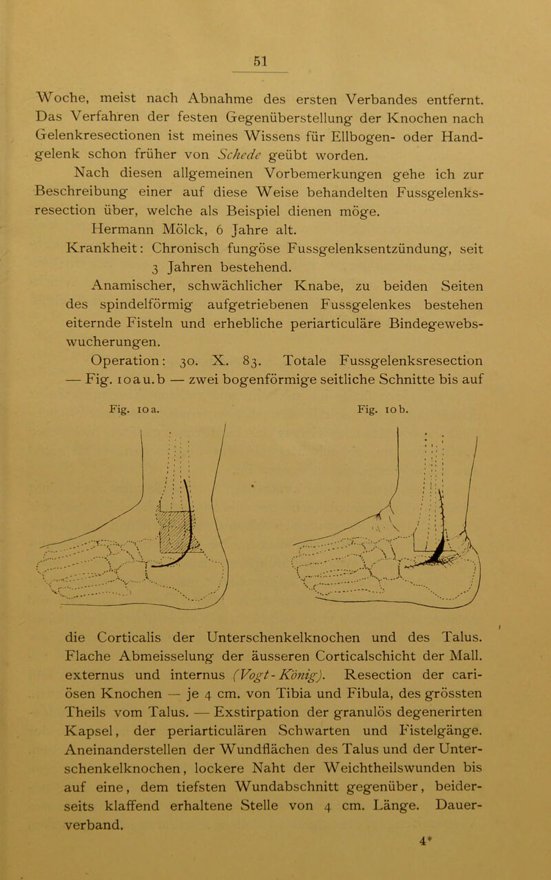 Woche, meist nach Abnahme des ersten Verbandes entfernt. Das Verfahren der festen Gegenüberstellung der Knochen nach Gelenkresectionen ist meines Wissens für Ellbogen- oder Hand- gelenk schon früher von Schede geübt worden. Nach diesen allgemeinen Vorbemerkungen gehe ich zur Beschreibung einer auf diese Weise behandelten Fussgelenks- resection über, welche als Beispiel dienen möge. Hermann Mölck, 6 Jahre alt. Krankheit: Chronisch fungöse Fussgelenksentzündung, seit 3 Jahren bestehend. Anämischer, schwächlicher Knabe, zu beiden Seiten des spindelförmig aufgetriebenen Fussgelenkes bestehen eiternde Fisteln und erhebliche periarticuläre Bindegewebs- wucherungen. Operation: 30. X. 83. Totale Fussgelenksresection — Fig. ioau.b — zwei bogenförmige seitliche Schnitte bis auf Fig. 10 a. Fig. 10 b. die Corticalis der Unterschenkelknochen und des Talus. Flache Abmeisselung der äusseren Corticalschicht der Mall, externus und internus (Vogt- König). Resection der cari- ösen Knochen — je 4 cm. von Tibia und Fibula, des grössten Theils vom Talus. — Exstirpation der granulös degenerirten Kapsel, der periarticulären Schwarten und Fistelgänge. Aneinanderstellen der Wundflächen des Talus und der Unter- schenkelknochen , lockere Naht der Weichtheilswunden bis auf eine, dem tiefsten Wundabschnitt gegenüber, beider- seits klaffend erhaltene Stelle von 4 cm. Länge. Dauer- verband. 4*