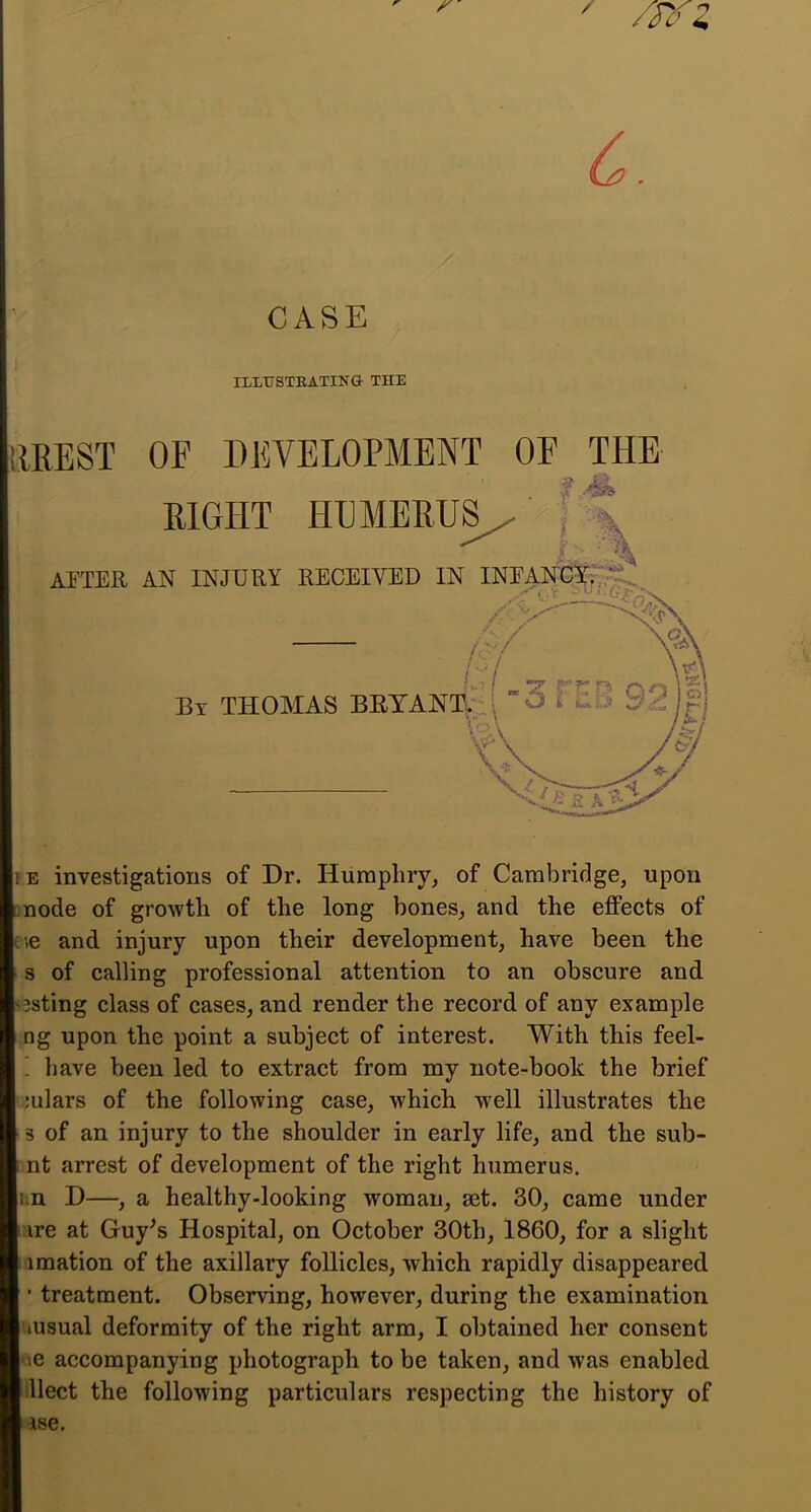 ILLUSTEATING- THE IREST OF DEVELOPMENT OF THE EIGHT HDMERUS^ APTER AN INJURY RECEIVED IN INEANCSr,,?, m ^ T r.D C\r\ By THOMAS BRYANT,.:- O i bd )|/ -^-V /47 IE investigations of Dr. Humphry, of Cambridge, upon •node of growth of the long bones, and the effects of ne and injury upon their development, have been the s of calling professional attention to an obscure and '3sting class of cases, and render the record of any example ng upon the point a subject of interest. With this feel- ! have been led to extract from my note-book the brief julars of the following case, which well illustrates the 3 of an injury to the shoulder in early life, and the sub- rnt arrest of development of the right humerus, un D—, a healthy-looking woman, set. 30, came under ire at Guy^s Hospital, on October 30th, 1860, for a slight imation of the axillary follicles, which rapidly disappeared • treatment. Observing, however, during the examination tusual deformity of the right arm, I obtained her consent ne accompanying photograph to be taken, and was enabled llect the following particulars respecting the history of