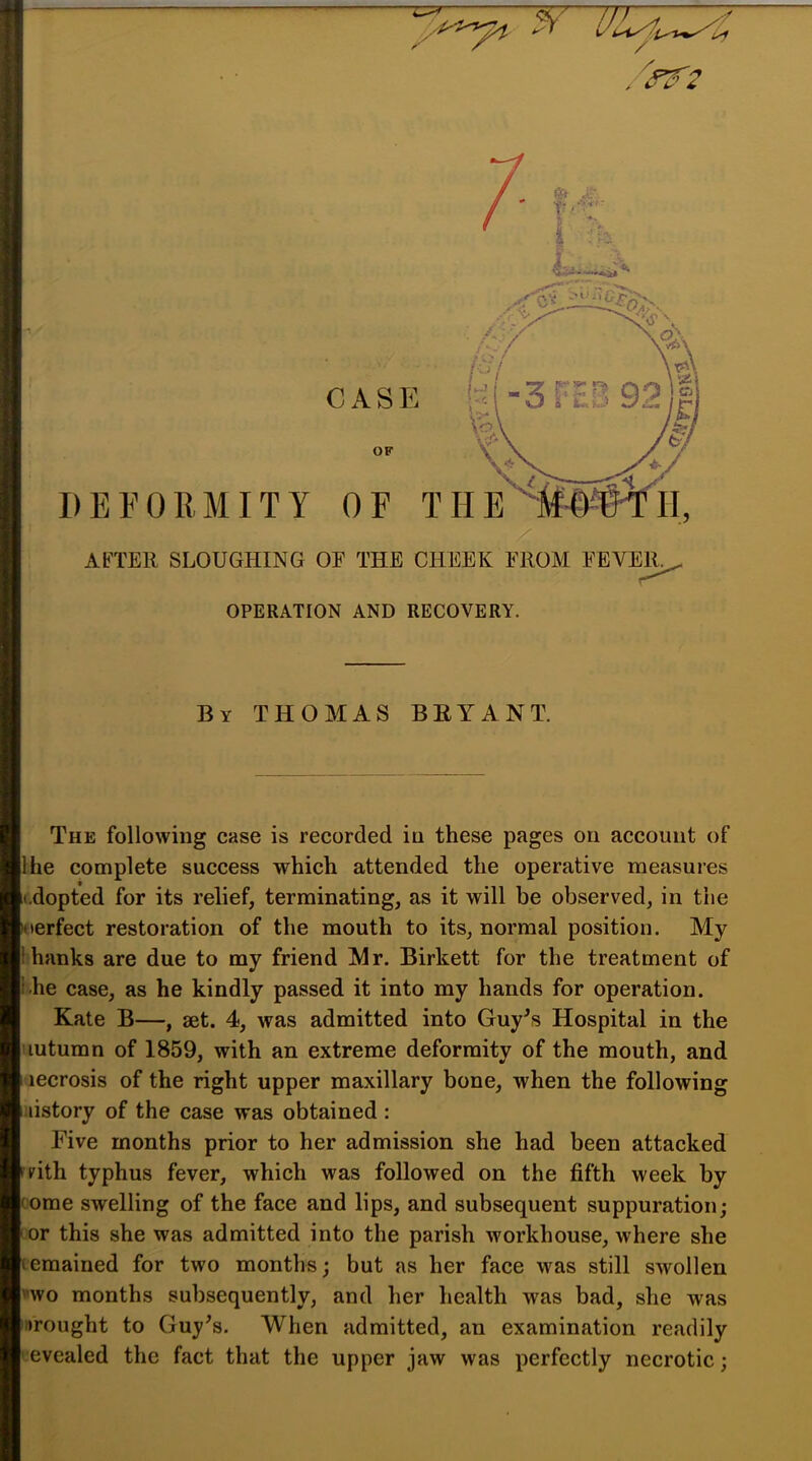 .^2 CASE OF tr/•'■'■ '.''k >N .-< 't- -I-3 FES 92 I m h X ■ N,. ^ DEFORMITY OF THE'*'^lif-0-WlI, AfTEll SLOUGHING OF THE CHEEK FROM FEVER.^ OPERATION AND RECOVERY. By THOMAS BRYANT. The following case is recorded in these pages on account of Ihe complete success which attended the operative measures dopted for its relief, terminating, as it will be observed, in the >oerfect restoration of the mouth to its, normal position. My hanks are due to my friend Mr. Birkett for the treatment of he case, as he kindly passed it into my hands for operation. Kate B—, aet. 4, was admitted into Guy^s Hospital in the lutumn of 1859, with an extreme deformity of the mouth, and lecrosis of the right upper maxillary bone, when the following listory of the case was obtained : Five months prior to her admission she had been attacked pith typhus fever, which was followed on the fifth week by ome swelling of the face and lips, and subsequent suppuration; or this she was admitted into the parish workhouse, where she emained for two months; but as her face was still swollen nvo months subsequently, and her health was bad, she was •rought to Guy^s. When admitted, an examination readily evealed the fact that the upper jaw was perfectly necrotic;