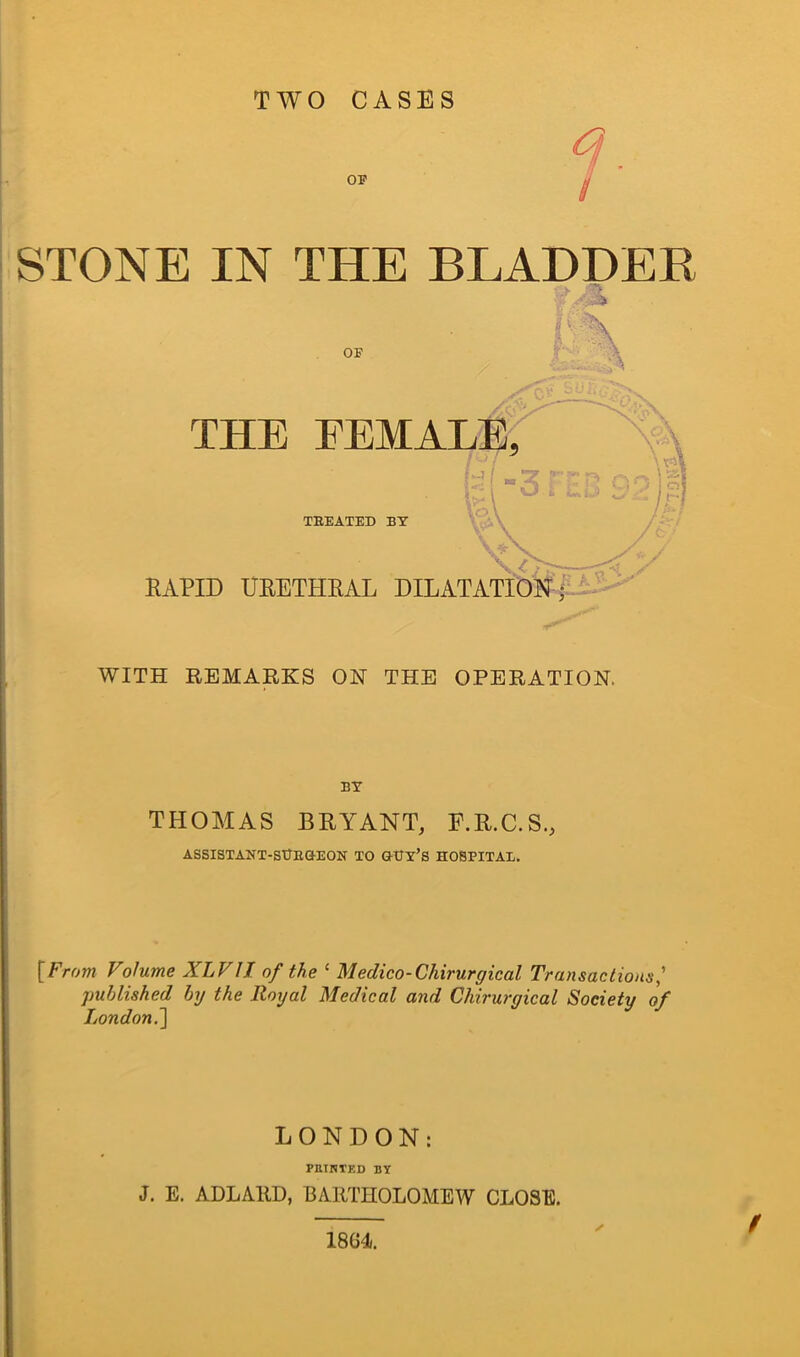 OF STONE IN THE BLADDER WITH REMARKS ON THE OPERATION. BY THOMAS BRYANT, F.R.C.S., ASSISTANT-SURGEON TO GUY’S HOBPITAE. [From Volume XLVIT of the 1 Medico-Chirurgical Transactions published by the Royal Medical and Chirurgical Society of London.'} LONDON: FEINTED BY J. E. ADLARD, BARTHOLOMEW CLOSE.