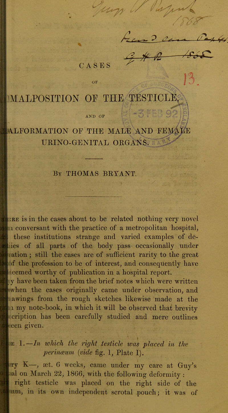 C A S E S B / ; V MALPOSITION OF THE TESTICLE, AND OF r.. t-, vJ li , ALFORMATION OF THE MALE AND FE] \ y URINO-GENITAL ORGANS. Bt THOMAS BRYANT. :re is in the cases about to be related nothing very novel i conversant with the practice of a metropolitan hospital, these institutions strange and varied examples of de- fies of all parts of the body pass occasionally under ation; still the cases are of sufficient rarity to the great >f the profession to be of interest, and consequently have •teemed worthy of publication in a hospital report, y have been taken from the brief notes which were written when the cases originally came under observation, and awings from the rough sketches likewise made at the 1 my note-book, in which it will be observed that brevity cription has been carefully studied and mere outlines een given, » ; , . ■ I iE 1 .—In which the right testicle was placed in the perinceum {vide fig. 1, Plate I). iry K—, set. G weeks, came under my care at Guy’s al on March 22, 18G6, with the following deformity : right testicle was placed on the right side of the nm, in its own independent scrotal pouch; it was of