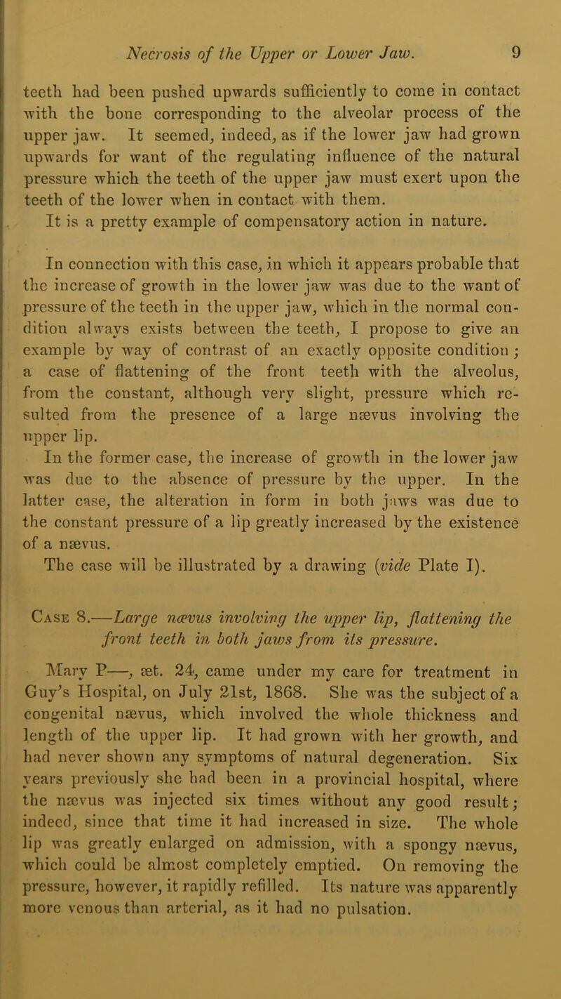 teeth had been pushed upwards sufficiently to eome in contact with the bone corresponding to the alveolar process of the upper jaw. It seemed, indeed, as if the lower jaw had grown upwards for want of the regulating influence of the natural pressure which the teeth of the upper jaw must exert upon the teeth of the lower when in contact with them. It is a pretty example of compensatory action in nature. In connection with this case, in which it appears probable that the increase of growth in the lower jaw was due to the want of pressure of the teeth in the upper jaw, which in the normal con- dition always exists between the teeth, I propose to give an example by way of contrast of an exactly opposite condition ; a case of flattening of the front teeth with the alveolus, from the constant, although very slight, pressure which re- sulted from the presence of a large nsevus involving the upper lip. In the former case, the increase of growth in the lower jaw was due to the absence of pressure by the upper. In the latter case, the alteration in form in both jaws was due to the constant pressure of a lip greatly increased by the existence of a nsevus. The case will be illustrated by a drawing [vide Plate I). Case 8.—Large ncevus involving the upper lip, flattening the front teeth in both jaws from its pressure. Mary P—, set. 24, came under my care for treatment in Guy^s Hospital, on July 2Ist, 1868. She was the subject of a congenital nsevus, which involved the whole thickness and length of the upper lip. It had grown with her growth, and had never shown any symptoms of natural degeneration. Six years previously she had been in a provincial hospital, where the nsevus was injected six times without any good result; indeed, since that time it had increased in size. The whole lip was greatly enlarged on admission, with a spongy nsevus, which could be almost completely emptied. On removing the pressure, however, it rapidly refilled. Its nature was apparently more venous than arterial, as it had no pulsation.