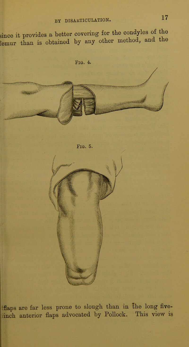 jince it provides a better covering for the condyles of the Eemur than is obtained by any other method, and the Fia. 4. Fia. 5. 'flaps are far less prone to slougli than in Ihe long five- .inch anterior flaps advocated by Pollock. This view is