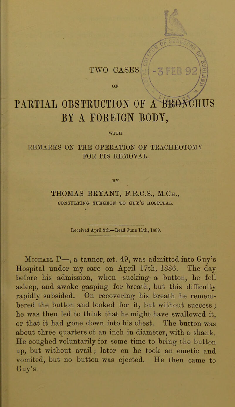 PAETIAL OBSTEUCTION O: OF BY A FOREIGN BODY, WITH REMARKS ON THE OPERATION OE TRACHEOTOMY FOR ITS REMOVAL. Michael P—, a tanner, aet. 49, was admitted into Guy^s Hospital under my care on April 17th, 1886. The day before his admission, when sucking- a button, he fell asleep, and awoke gasping for breath, but this difficulty rapidly subsided. On recovering his breath he remem- bered the button and looked for it, but without success; he was then led to think that he might have swallowed it, or that it had gone down into his chest. The button was about three quarters of an inch in diameter, with a shank. He coughed voluntarily for some time to bring the button up, but without avail; later on he took an emetic and vomited, but no button was ejected. He then came to Guy^s,, BY THOMAS BRYANT, F.R.C.S., M.Ch., CONSULTING SUBGEON TO GUY’S HOSPITAL. Received April 9th—Read June 11th, 1889.