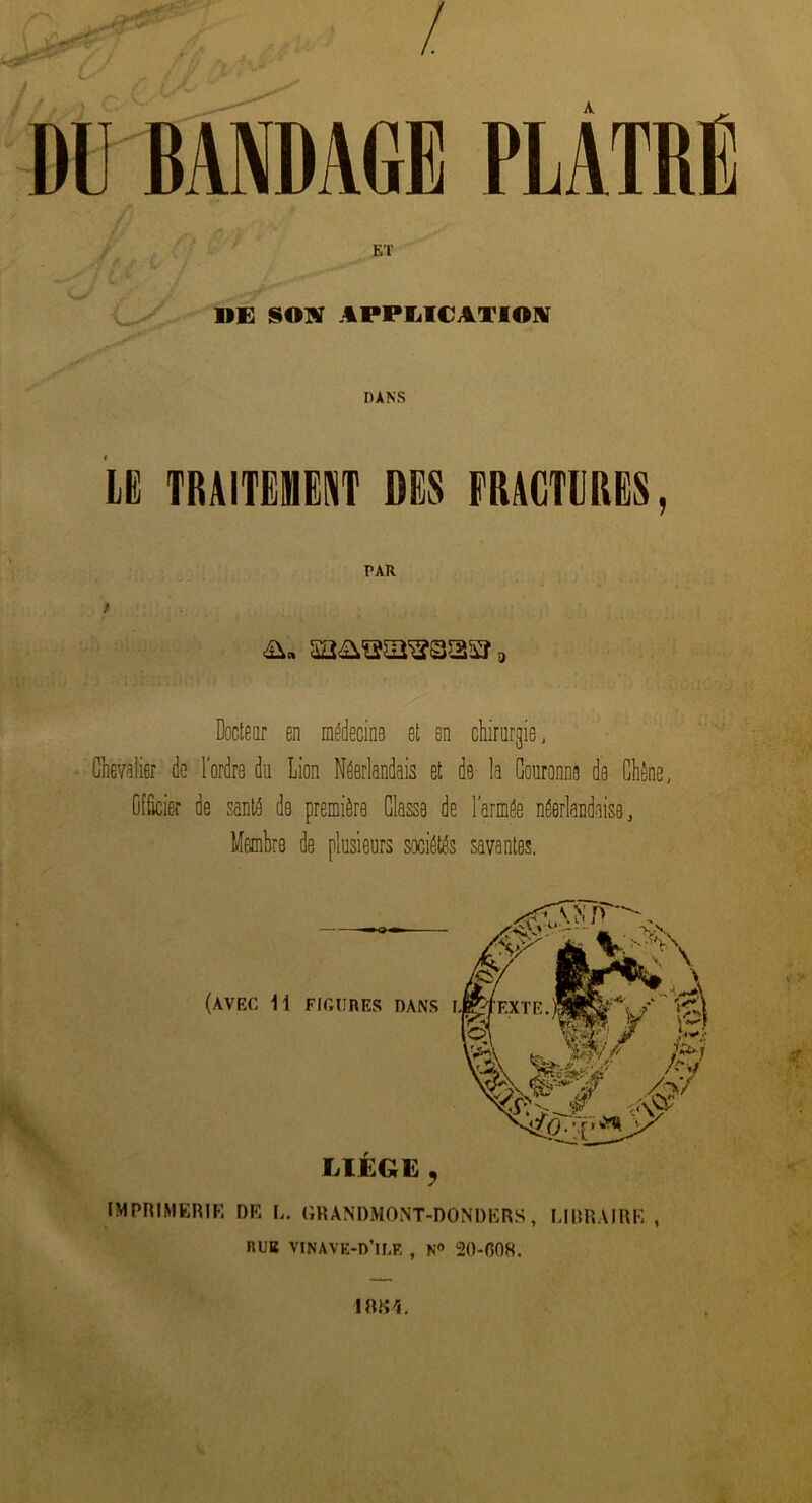 / DU BANDAGE PLÂTRE ET »E SOIN APPLICATION DANS LE TRAITEMENT DES FRACTURES, PAR f i, Docteur en médecine et en chirurgie, Chevalier de l'ordre du Lion Néerlandais et de la Couronne de Chêne, Officier de santé de première Classa de l'armée néerlandaise, Membre de plusieurs sociétés savantes. (AVEC 11 Flf.üRES DANS LIÈGE , IMPRIMERIE DF, I,. GRANDMONT-DONDERS, LIBRAIRE , RUB VINAVE-D’IIjE , N° 20-608. 1884.