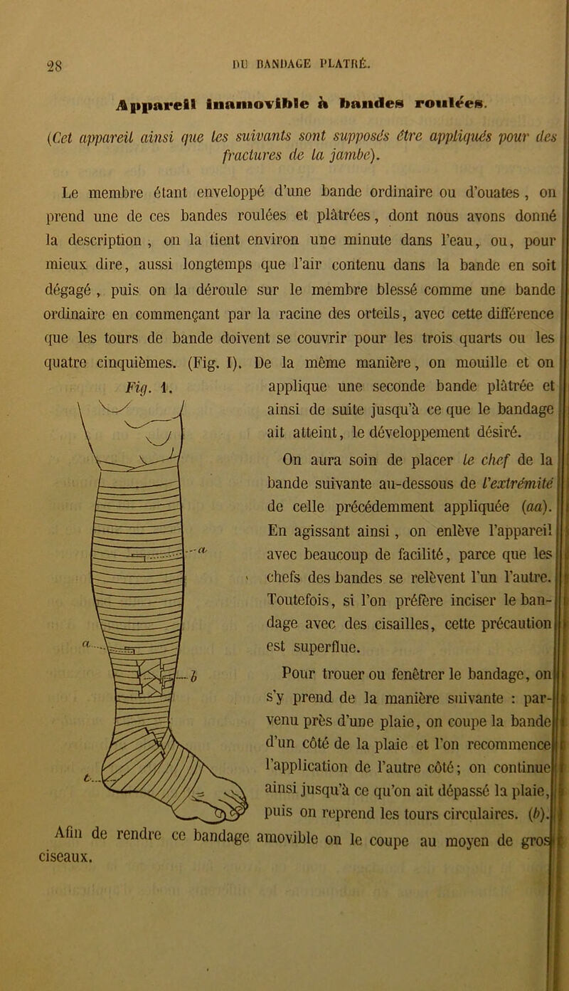 Appareil inamovible à bandes ronlees. (Cet appareil ainsi que les suivants sont supposas être appliqués pour des fractures de la jambe). Le membre étant enveloppé d’une bande ordinaire ou d’ouates , on prend une de ces bandes roulées et plâtrées, dont nous avons donné la description , on la tient environ une minute dans l’eau, ou, pour mieux dire, aussi longtemps que l’air contenu dans la bande en soit dégagé , puis on la déroule sur le membre blessé comme une bande ordinaire en commençant par la racine des orteils, avec cette différence que les tours de bande doivent se couvrir pour les trois quarts ou les quatre cinquièmes. (Fig. I). De la même manière, on mouille et on applique une seconde bande plâtrée et ainsi de suite jusqu’à ce que le bandage ait atteint, le développement désiré. On aura soin de placer le chef de la bande suivante an-dessous de l'extrémité de celle précédemment appliquée (an) En agissant ainsi, on enlève l’apparei1 avec beaucoup de facilité, parce que les chefs des bandes se relèvent l'un l’autre. Toutefois, si l’on préfère inciser le ban- dage avec des cisailles, cette précaution est superflue. Pour trouer ou fenêtrer le bandage, on s’y prend de la manière suivante : par- venu près d’une plaie, on coupe la bande d’un côté de la plaie et l'on recommence l’application de l’autre côté; on continue ainsi jusqu’à ce qu’on ait dépassé la plaie, puis on reprend les tours circulaires, (b) Afin de rendre ce bandage amovible on le coupe au moyen de gro: ciseaux. :!