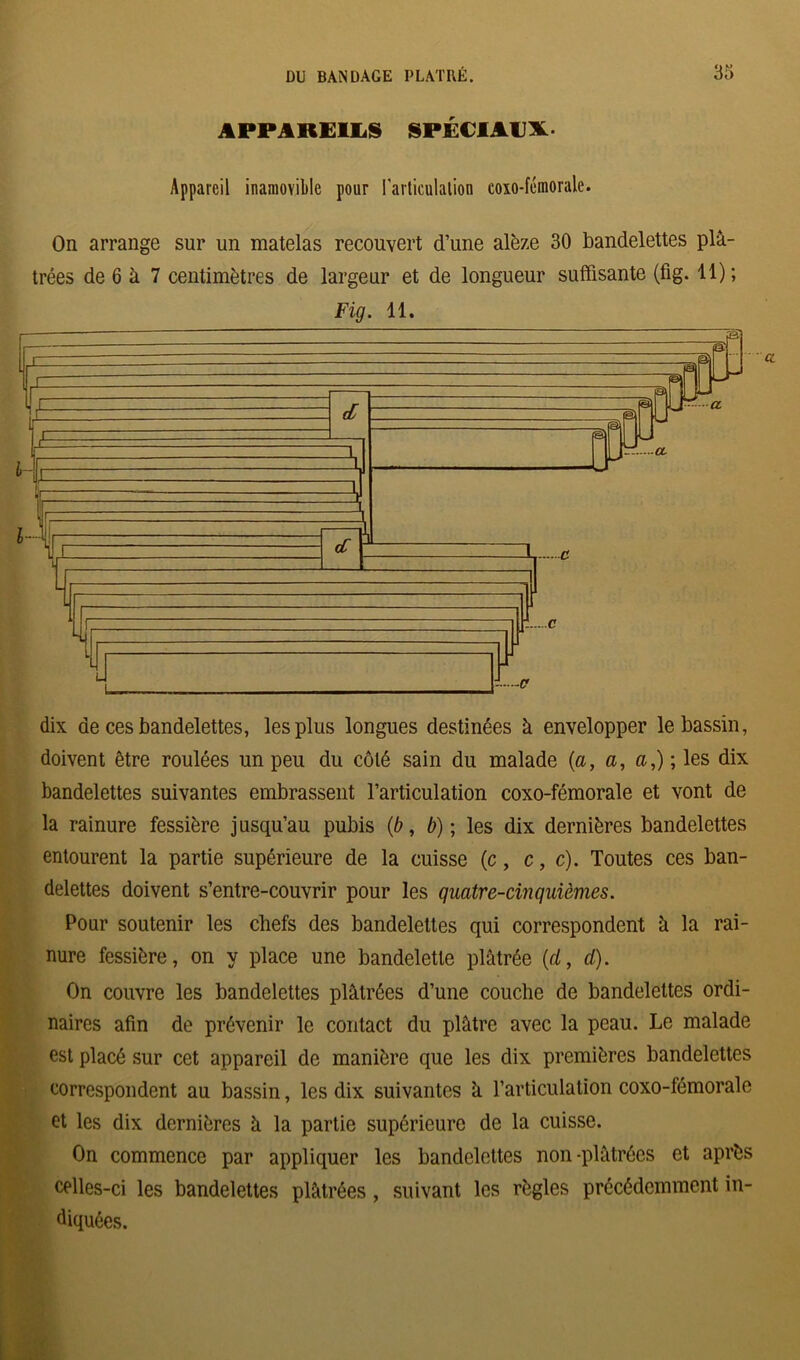 APPAREILS SPÉCIAUX. Appareil inamovible pour l'articulalion coxo-fémorale. On arrange sur un matelas recouvert d’une alèze 30 bandelettes plâ- trées de 6 à 7 centimètres de largeur et de longueur suffisante (fig. 11); Fig. 11. dix de ces bandelettes, les plus longues destinées à envelopper le bassin, doivent être roulées un peu du côté sain du malade {a, a, a,) ; les dix bandelettes suivantes embrassent l’articulation coxo-fémorale et vont de la rainure fessière jusqu’au pubis {b, b); les dix dernières bandelettes entourent la partie supérieure de la cuisse (c, c, c). Toutes ces ban- delettes doivent s’entre-couvrir pour les quatre-cinquièmes. Pour soutenir les chefs des bandelettes qui correspondent à la rai- nure fessière, on y place une bandelette plâtrée {cl, d). On couvre les bandelettes plâtrées d’une couche de bandelettes ordi- naires afin de prévenir le contact du plâtre avec la peau. Le malade est placé sur cet appareil de manière que les dix premières bandelettes correspondent au bassin, les dix suivantes à l’articulation coxo-fémorale et les dix dernières à la partie supérieure de la cuisse. On commence par appliquer les bandelettes non-plâtrées et après celles-ci les bandelettes plâtrées , suivant les règles précédemment in- diquées.