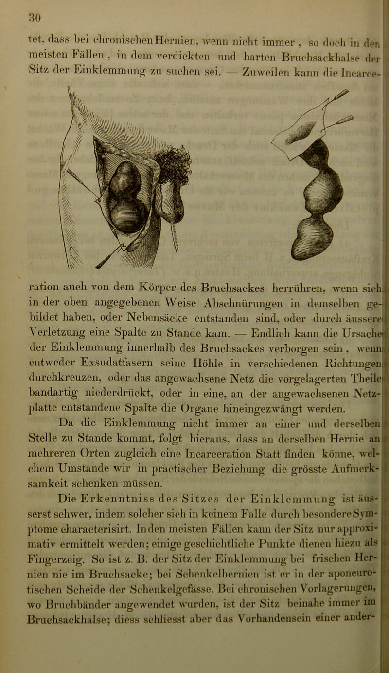 tet. dass bei chronischen Hernien, wenn nicht immer , so doch in den meisten Fällen, in dem verdickten und harten Bruchsackhalse der Sit/, der Einklemmung zu suchen sei. — Zuweilen kann die Incaree- ration auch von dem Körper des Bruchsackes herrühren, wenn siehi in der oben angegebenen Weise Abschnürungen in demselben ge— | bildet haben, oder Nebensäcke entstanden sind, oder durch äussere! Verletzung eine Spalte zu Stande kam. — Endlich kann die Ursache der Einklemmung innerhalb des Bruchsackes verborgen sein , wenn! entweder Exsudatfasern seine Höhle in verschiedenen Richtungen! durchkreuzen, oder das angewachsene Netz die vorgelagerten Theilet bandartig niederdrückt, oder in eine, an der angewachsenen Netz- : platte entstandene Spalte die Organe hineingezwängt werden. Da die Einklemmung nicht immer an einer und derselben : Stelle zu Stande kommt, folgt hieraus, dass an derselben Hernie an • mehreren Orten zugleich eine Incarceration Statt finden könne, wel- chem Umstande wir in praetischer Beziehung die grösste Aufmerk- samkeit schenken müssen. Die Erkenntniss des Sitzes der Einklemmung ist aus- ) serst schwer, indem solcher sich in keinem Falle durch besondereSym- !i ptome characterisirt. Inden meisten Fällen kann der Sitz nur approxi- 9 mativ ermittelt werden; einige geschichtliche Punkte dienen hiezu als k Fingerzeig. So ist z. B. der Sitz der Einklemmung bei frischen Her- nien nie im Bruchsacke; bei Schenkelhernien ist er in der aponeuro- I» tischen Scheide der Schenkelgcfässe. Bei chronischen Vorlagerungen, ; wo Bruchbänder angewendet wurden, ist der Sitz beinahe immer im Bruchsackhalse; diess schliesst aber das Vorhandensein einer ander-