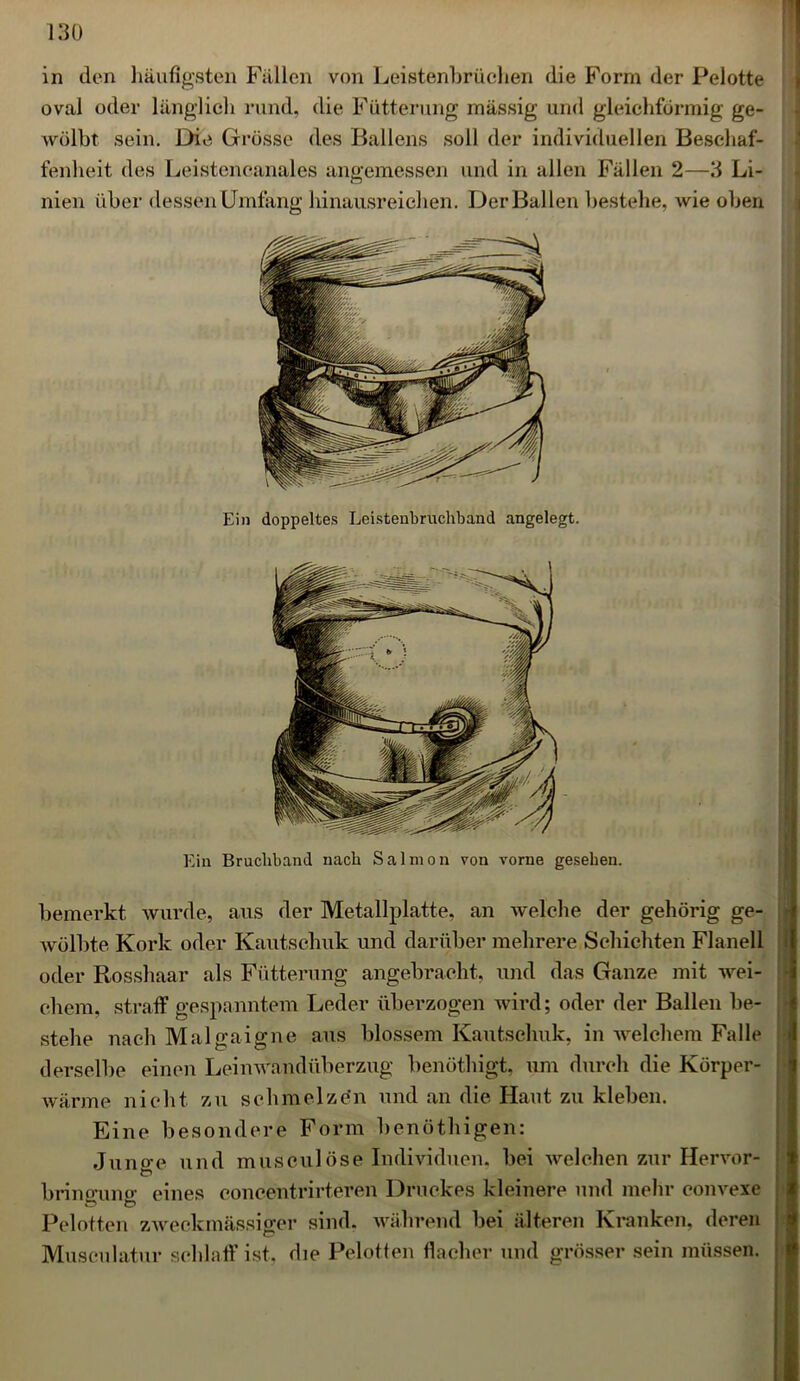 in den häufigsten Fällen von Leistenbrüchen die Form der Pelotte oval oder länglich rund, die Fütterung massig und gleichförmig ge- wölbt sein. Die Grösse des Ballens soll der individuellen Beschaf- fenheit des Leistencanales angemessen und in allen Fällen 2—3 Li- nien über dessen Umfang hinausreichen. Der Ballen bestehe, wie oben Ein Bruchband nach Salmon von vorne gesehen. bemerkt wurde, aus der Metallplatte, an welche der gehörig ge- wölbte Kork oder Kautschuk und darüber mehrere Schichten Flanell oder Rosshaar als Fütterung angebracht, und das Ganze mit wei- chem, straff gespanntem Leder überzogen wird; oder der Ballen be- stehe nach Malgaigne aus blossem Kautschuk, in welchem Falle derselbe einen Leinwandüberzug benöthigt, um durch die Körper- wärme nicht zu schmelzen und an die Haut zu kleben. Eine besondere Form benöthigen: Junge und musculöse Individuen, bei welchen zur Hervor- brino-uno- eines concentrirteren Druckes kleinere und mehr convexe Pelotten zweckmässiger sind, während bei älteren Kranken, deren Musculatur schlaff ist, die Pelotten flacher und grösser sein müssen.