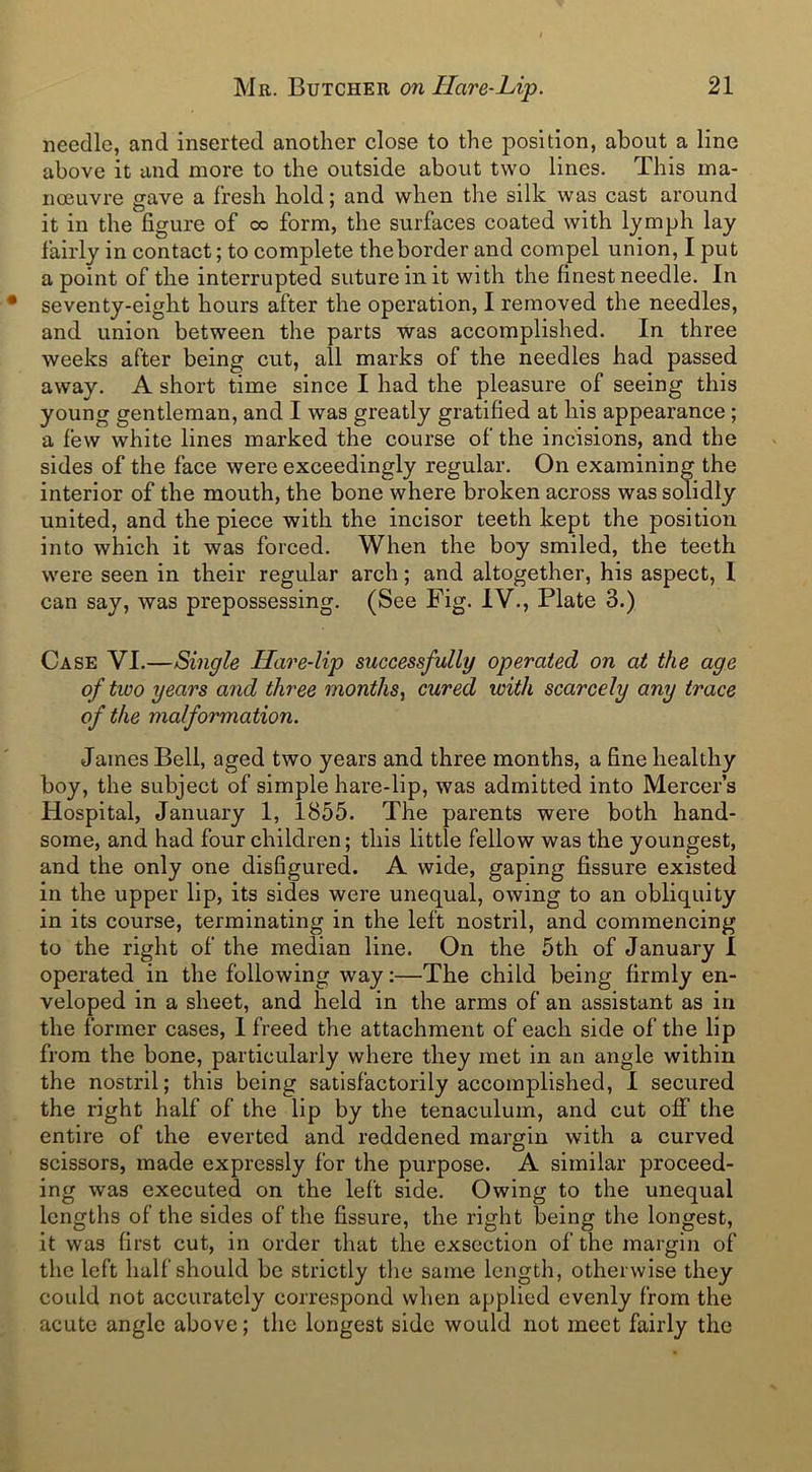 needle, and inserted another close to the position, about a line above it and more to the outside about two lines. This ma- noeuvre gave a fresh hold; and when the silk was cast around it in the figure of oo form, the surfaces coated with lymph lay fairly in contact; to complete theborder and compel union, I put a point of the interrupted suture in it with the finest needle. In seventy-eight hours after the operation, I removed the needles, and union between the parts was accomplished. In three weeks after being cut, all marks of the needles had passed away. A short time since I had the pleasure of seeing this young gentleman, and I was greatly gratified at his appearance; a few white lines marked the course of the incisions, and the sides of the face were exceedingly regular. On examining the interior of the mouth, the bone where broken across was solidly united, and the piece with the incisor teeth kept the position into which it was forced. When the boy smiled, the teeth were seen in their regular arch; and altogether, his aspect, I can say, was prepossessing. (See Fig. IV., Plate 3.) Case VI.—Single Hare-lip successfully operated on at the age of two years and three months, cured with scarcely any trace of the malformation. James Bell, aged two years and three months, a fine healthy boy, the subject of simple hare-lip, was admitted into Mercer’s Hospital, January 1, 1855. The parents were both hand- some, and had four children; this little fellow was the youngest, and the only one disfigured. A wide, gaping fissure existed in the upper lip, its sides were unequal, owing to an obliquity in its course, terminating in the left nostril, and commencing to the right of the median line. On the 5th of January I operated in the following way:—The child being firmly en- veloped in a sheet, and held in the arms of an assistant as in the former cases, I freed the attachment of each side of the lip from the bone, particularly where they met in an angle within the nostril; this being satisfactorily accomplished, I secured the right half of the lip by the tenaculum, and cut off the entire of the everted and reddened margin with a curved scissors, made expressly lor the purpose. A similar proceed- ing was executed on the left side. Owing to the unequal lengths of the sides of the fissure, the right being the longest, it was first cut, in order that the exsection of the margin of the left half should be strictly the same length, otherwise they could not accurately correspond when applied evenly from the acute angle above; the longest side would not meet fairly the