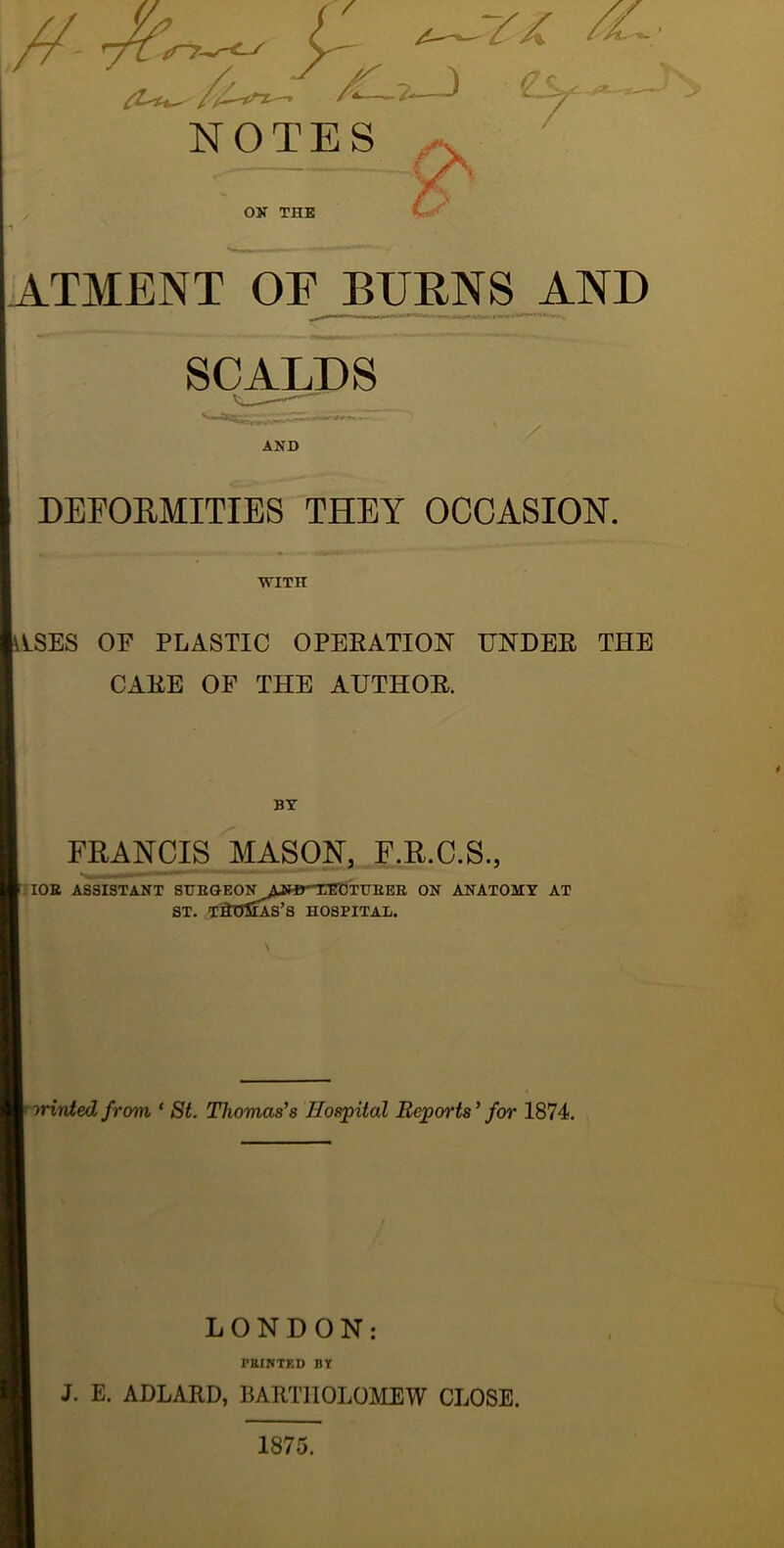 ATMENT OF BUBNS AND SCALDS AND DEFOEMITIES THEY OCCASION. WITH ASES OF PLASTIC OPEEATION UNDER THE CARE OF THE AUTHOR. BY FRANCIS MASON, F.R.C.S., ;iOB ASSISTANT SUKGEON^WirT^OTirEEE ON ANATOMY AT ST. TaOlSAS’s HOSPITAL. nrinted from, ‘ 8t. Thomas’s Hospital Reports’ for 1874. LONDON: PRINTED BY J. E. ADLARD, BARTHOLOMEW CLOSE. 1875.