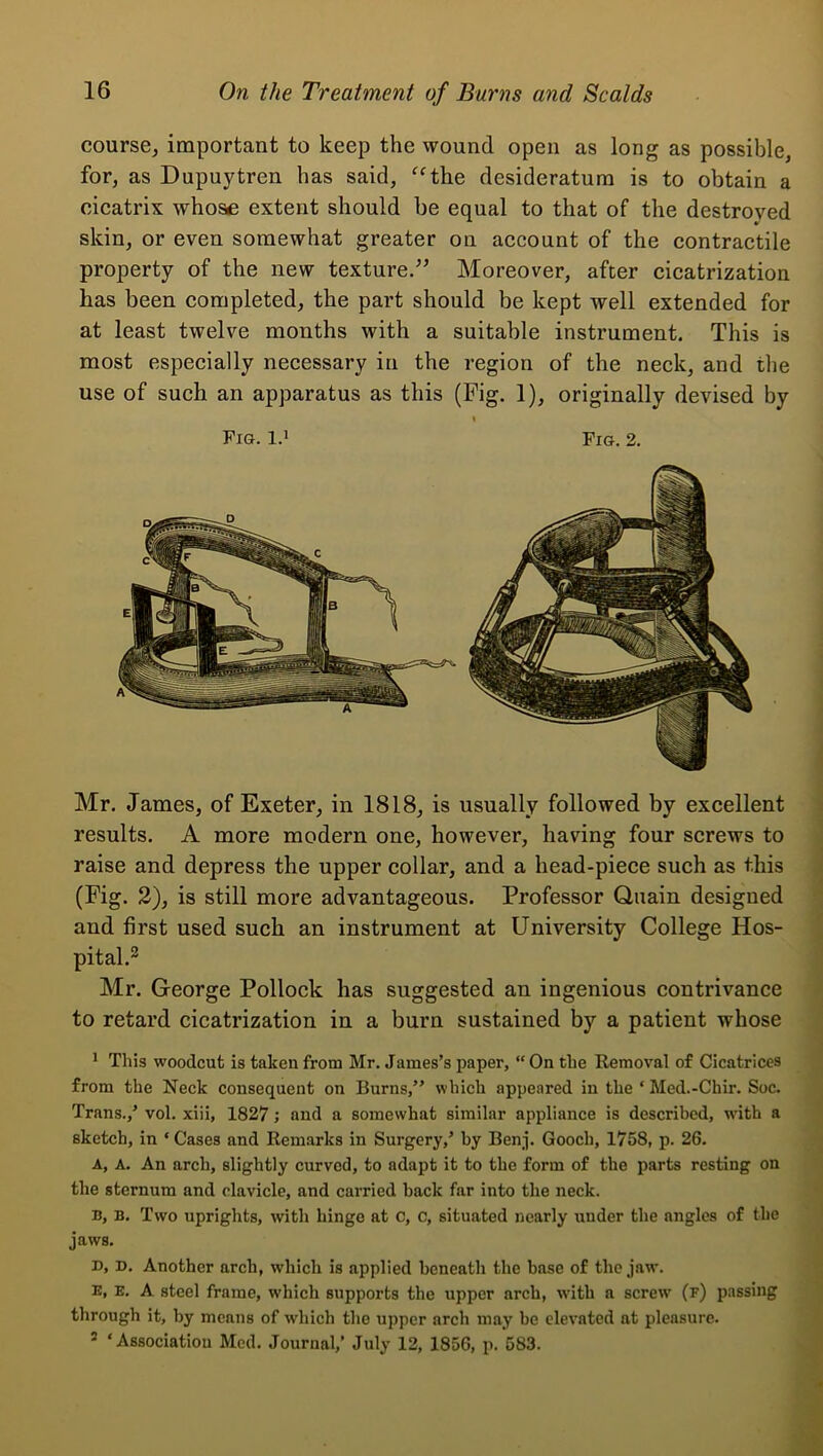 course, important to keep the wound open as long as possible, for, as Dupuytren has said, ‘^the desideratum is to obtain a cicatrix whose extent should be equal to that of the destroyed skin, or even somewhat greater on account of the contractile property of the new texture/^ Moreover, after cicatrization has been completed, the part should be kept well extended for at least twelve months with a suitable instrument. This is most especially necessary in the region of the neck, and the use of such an apparatus as this (Pig. 1), originally devised by Fig. 1.* Fig. 2. Mr. James, of Exeter, in 1818, is usually followed by excellent ] results. A more modern one, however, having four screws to raise and depress the upper collar, and a head-piece such as this (Fig. 2), is still more advantageous. Professor Quain designed and first used such an instrument at University College Hos- pital.^ Mr. George Pollock has suggested an ingenious contrivance ' to retard cicatrization in a burn sustained by a patient whose 1 This woodcut is taken from Mr. James’s paper,  On the Removal of Cicatrices from the Neck consequent on Burns,” which appeared in the ‘ Med.-Chir. Soc. Trans.,’ vol. xiii, 1827; and a somewhat similar appliance is described, with a sketch, in ‘ Cases and Remarks in Surgery,’ by Benf. Gooch, 1758, p. 26. A, A. An arch, slightly curved, to adapt it to the form of the parts resting on the sternum and clavicle, and carried back far into the neck. B, B. Two uprights, with hinge at c, c, situated nearly under the angles of the jaws. B, D. Another arch, which is applied beneath the base of the jaw. K, E. A steel frame, which supports the upper arch, with a screw (f) passing through it, by means of which the upper arch may be elevated at pleasure. = ‘Association Med. Journal,’ July 12, 1856, p. 583.