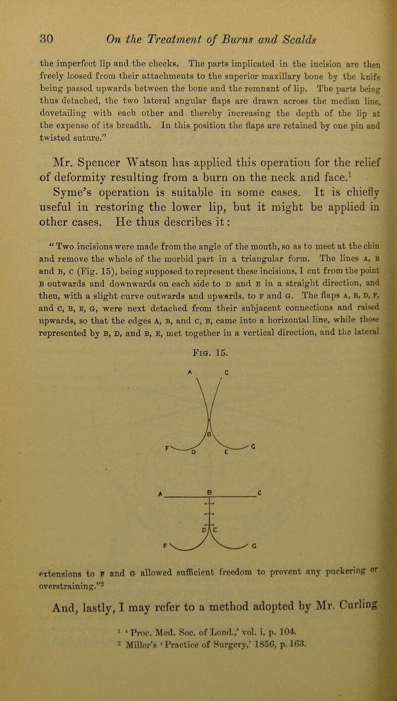 the imperfect lip and the cheeks. The parts implicated in the incision are then freely loosed from their attachments to the superior maxillary bone by the knife being passed upwards between the bone and the remnant of lip. The parts being thus detached, the two lateral angular flaps are drawn across the median line, dovetailing with each other and thereby increasing the depth of the lip at the expense of its breadth. In this, position the flaps are retained by one pin and twisted suture.” Mr. Spencer Watson has applied this operation for the relief of deformity resulting from a burn on the neck and face.^ Syme’s operation is suitable in some cases. It is chiefly useful in restoring the lower lip, but it might be applied in other cases. He thus describes it: “ Two incisions were made from the angle of the mouth, so as to meet at the chin and remove the whole of the morbid part in a triangular form. The lines A, B and B, c (Fig. 15), being supposed to represent these incisions, I cut from the point B outwards and downwards on each side to T> and e in a straight direction, and then, with a slight curve outwards and upwards, to E and G. The flaps A, B, D, F, and c, B, E, G, were next detached from their subjacent connections and raised upwards, so that the edges A, B, and c, B, came into a horizontal line, while those represented by B, T>, and B, E, met together in a vertical direction, and the lateral ^ Pig. 15. A C extensions to T and G allowed sufficient freedom to prevent any puckering or overstraining.”^ And, lastly, I may refer to a method adopted by Mr. Curling ’ ‘ Proc. Med. Soc. of Lond.,’ vol. i, p. 104. * Miller’s ‘ Practice of Surgery,’ 185G, p. 1G3.