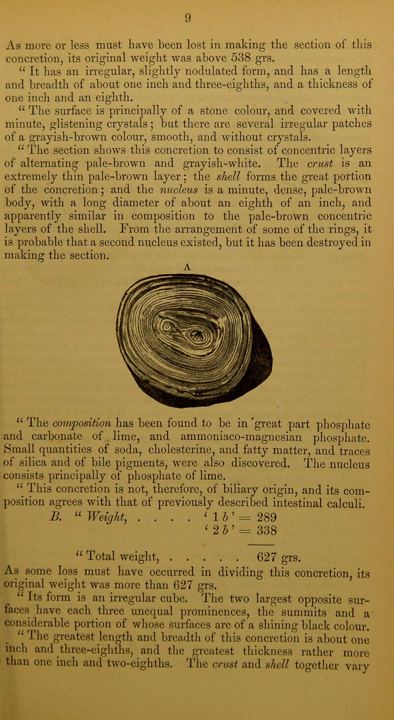 As more or less must have been lost in making the section of this concretion, its original weight was above 538 grs. “ It has an irregular, slightly nodulated form, and has a length and breadth of about one inch and three-eighths, and a thickness of one inch and an eighth. u The surface is principally of a stone colour, and covered with minute, glistening crystals ; but there are several irregular patches of a grayish-brown colour, smooth, and without crystals. u The section shows this concretion to consist of concentric layers of alternating pale-brown and grayish-white. The crust is an extremely thin pale-brown layer; the shell forms the great portion of the concretion; and the nucleus is a minute, dense, pale-brown body, with a long diameter of about an eighth of an inch, and apparently similar in composition to the pale-brown concentric layers of the shell. From the arrangement of some of the rings, it is probable that a second nucleus existed, but it has been destroyed in making the section. A 11 The composition has been found to be in 'great part phosphate and carbonate of lime, and ammoniaco-magnesian phosphate. Small quantities of soda, cholesterine, and fatty matter, and traces of silica and of bile pigments, were also discovered. The nucleus consists principally of phosphate of lime. “ This concretion is not, therefore, of biliary origin, and its com- position agrees with that of previously described intestinal calculi. B. u Weight, . . . . 1 1 h ’ = 289 ‘ 2 h ’ = 338 11 Total weight, 627 grs. As some loss must have occurred in dividing this concretion, its original weight was more than 627 grs. “ Its form is an irregular cube. The two largest opposite sur- faces have each three unequal prominences, the summits and a considerable portion of whose surfaces are of a shining black colour. u I’greatest length and breadth of this concretion is about one inch and three-eighths, and the greatest thickness rather more than one inch and two-eighths. The crust and shell together vary
