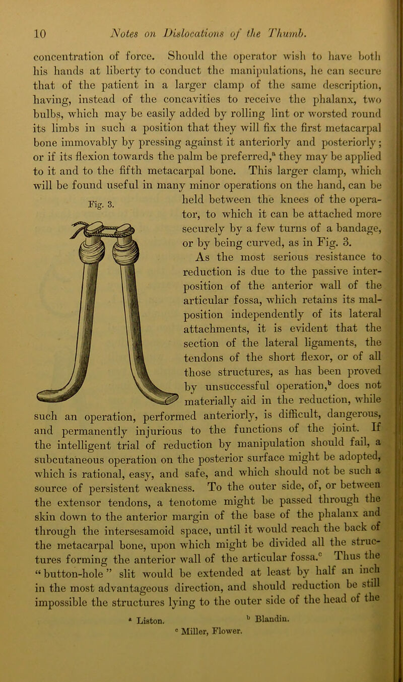 concentration of force. Shonld the operator wish to have hotli liis hands at liberty to conduct the manipulations, he can secure that of the patient in a larger clamp of the same description, having, instead of the concavities to receive the phalanx, two bulbs, which may be easily added by rolling lint or worsted round its limbs in such a position that they will fix the first metacarpal bone immovably by pressing against it anteriorly and posteriorly; or if its flexion towards the palm be preferred,® they may be applied to it and to the fifth metacarpal bone. This larger clamp, which will be found useful in many minor operations on the hand, can be rig. 3. held between the knees of the opera- tor, to which it can be attached more securely by a few turns of a bandage, or by being curved, as in Fig. 3. As the most serious resistance to reduction is due to the passive inter- position of the anterior wall of the articular fossa, which retains its mal- position independently of its lateral attachments, it is evident that the section of the lateral ligaments, the tendons of the short flexor, or of all those structures, as has been proved by unsuccessful operation,’’ does not materially aid in the reduction, while such an operation, performed anteriorly, is difficult, dangerous, and permanently injurious to the functions of the joint. If the intelligent trial of reduction by manipulation should fail, a subcutaneous operation on the posterior surface might be adopted, which is rational, easy, and safe, and which should not be such a source of persistent weakness. To the outer side, of, or between the extensor tendons, a tenotome might be passed through the skin down to the anterior margin of the base of the phalanx and through the intersesamoid space, until it would reach the back of the metacarpal bone, upon which might be divided all the struc- tures forming the anterior wall of the articular fossa.® Thus the “ button-hole ” slit would be extended at least by half an inch in the most advantageous direction, and should reduction be still impossible the structures lying to the outer side of the head of the Blandin. ® Miller, Flower. • Liston. I