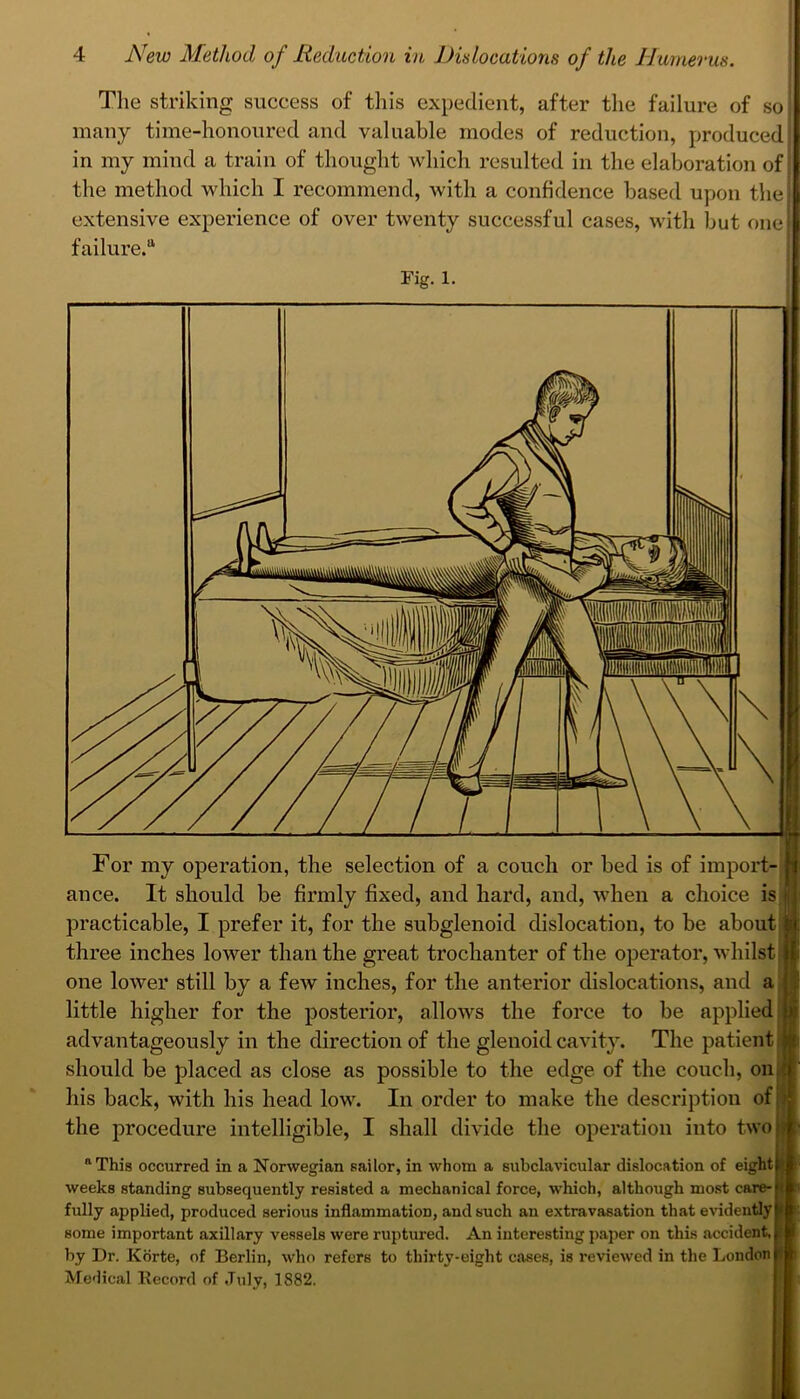 The striking success of this expedient, after the failure of so many time-honoured and valuable modes of reduction, produced in my mind a train of thought which resulted in the elaboration of the method which I recommend, with a confidence based upon the extensive experience of over twenty successful cases, with but one failure.^ Fig. 1. For my operation, the selection of a couch or bed is of import- ance. It should be firmly fixed, and hard, and, when a choice is practicable, I prefer it, for the subglenoid dislocation, to be about three inches lower than the great trochanter of the operator, whilst one lower still by a few inches, for the anterior dislocations, and a t little higher for the posterior, allows the force to be applied advantageously in the direction of the glenoid cavity. The patient should be placed as close as possible to the edge of the couch, on his back, with his head low. In order to make the description of the procedure intelligible, I shall divide the operation into two “This occurred in a Norwegian sailor, in whom a subclavicular dislocation of eight weeks standing subsequently resisted a mechanical force, which, although most care-f fully applied, produced serious inflammation, and such an extravasation that evidently some important axillary vessels were ruptured. An interesting paper on this accident,! by Dr. Kiirte, of Berlin, who refers to thirty-eight cases, is reviewed in the London Medical liecord of July, 1882. t