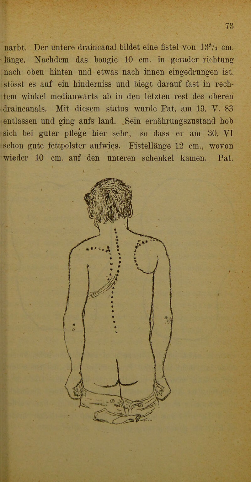 narbt. Der untere draincanal bildet eine fistel von 13s/4 cm. länge. Nachdem das bougie 10 cm. in gerader richtung nach oben hinten und etwas nach innen eingedrungen ist, stösst es auf ein hinderniss und biegt darauf fast in rech- tem winkel medianwärts ab in den letzten rest des oberen draincanals. Mit diesem status wurde Pat. am 13. V. 83 entlassen und ging aufs land. „Sein ernährungszustand hob sich bei guter pflege hier sehr, so dass er am 30. VI schon gute fettpolster aufwies. Fistellänge 12 cm., wovon wieder 10 cm. auf den unteren schenke! kamen. Pat. <