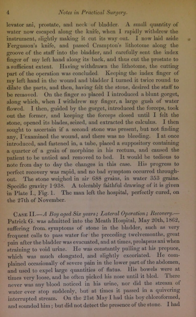 levator anl, prostate, and neck of bladder. A small (juantity of water now escaped along the knife, when I rapidly withdrew the instrument, slightly making it cut its way out. I now laid aside Fergusson’s knife, and j)!issed Crampton’s lithotome along the groove of the staff into the bladder, and carefully sent the index finger of my left liand along its back, and thus cut the prostate to a sufficient extent. Having withdrawn the lithotome, the cutting part of the operation Avas concluded. Keei>ing the index finger of my left hand in the wound and bhidder 1 turned it twice round to dilate the parts, and then, having felt the stone, desired the sttiff to be removed. On the finger so placed I introduced a blunt gorget, along Avhich, when I AvithdrcAV my finger, a large gush of Avater flowed. I then, guided by the gorget, introduced the forceps, took out the former, and keeping the forceps closed until I felt the stone, opened its blades, seized, and extracted the calculus. I then sought to ascertain if a second stone Avas present, but not finding any, I examined the Avound, and there Avas no bleeding. I at once introduced, and fiistened in, a tube, placed a suppository containing a quarter of a grain of morphine in his rectum, and caused the patient to be untied and removed to bed. It Avould be tedious to note from day to day the changes in this case. His })i’ogress to perfect recovery Avas rapid, and no biul symptom occurred through- out. The stone Aveighed in air G88 grains, in Avater 353 grains. Specific gravity 1-938. A tolerably faithful draAving of it is given in Plate I., Fig. 1. The man left the hospital, perfectly cured, on the 27 th of November. Case II.—A Boy aged Siv years; Lateral Operation; Recovery.— Patrick G. Avas admitted into the Meath Hospital, May 20th, 1862, suffering from symptoms of stone in the bladder, such as very frequent calls to pass Avater for the preceding tAVclvemonths, great pain after the bladder was evacuated, and at times, prolapsus ani Avhen straining to void urine. He Avas constantly pulling at his prepuce, Avhich Avas much elongated, and slightly excoriated. lie com- plained occasionally of severe pain in the loAver part of the abdomen, and used to expel large quantities of flatus. His boAvels Avere at times A'ery loose, and he often picked his nose until it bled. Ihcie never Avas any blood noticed in his urine, nor did the stream of Avater ever stop suddenly, but at times it passed in a quivering interrupted .stream. On the 21st IMay I had this boy chloiofoimed, and sounded him; but did not detect the presence of the stone. I had