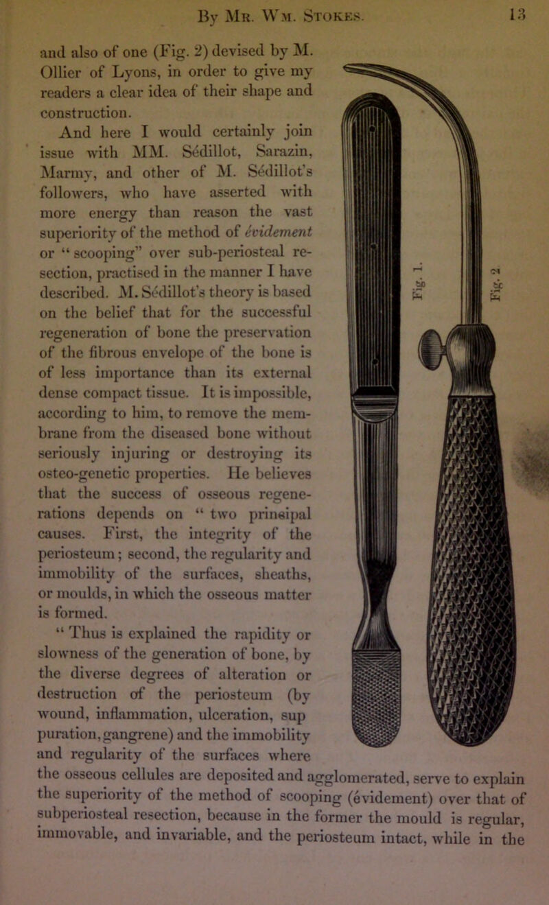 and also of one (Fig. 2) devised by M. Ollier of Lyons, in order to give my readers a clear idea of their shape and construction. And here I would certainly join issue with MM. Sedillot, Sarazin, Manny, and other of M. Sedillot’s followers, who have asserted with more energy than reason the vast superiority of the method of ^videment or “ scooping” over sub-periosteal re- section, practised in the manner I have described. .M. Sodillot’s theory is based on the belief that for the successful regeneration of bone the preservation of the fibrous envelope of the bone is of less importance than its external dense compact tissue. It is impossible, according to him, to remove the mem- brane from the diseased bone without seriously injuring or destroying its osteo-gcnetic properties. He believes that the success of osseous regene- rations depends on “ two prineipal causes. First, the integrity of the periosteum; second, the regularity and immobility of the surfaces, sheaths, or moulds, in which the osseous matter is formed. “ Thus is explained the rapidity or slowness of the generation of bone, by the diverse degrees of alteration or destruction of the periosteum (by wound, inflammation, ulceration, sup puration,gangrene) and the immobility and regularity of the surfaces where the osseous cellules are deposited and agglomerated, serve to explain the superiority of the method of scooping (evidement) over that of subperiosteal resection, because in the former the mould is regular, immovable, and invariable, and the periosteum intact, while in the